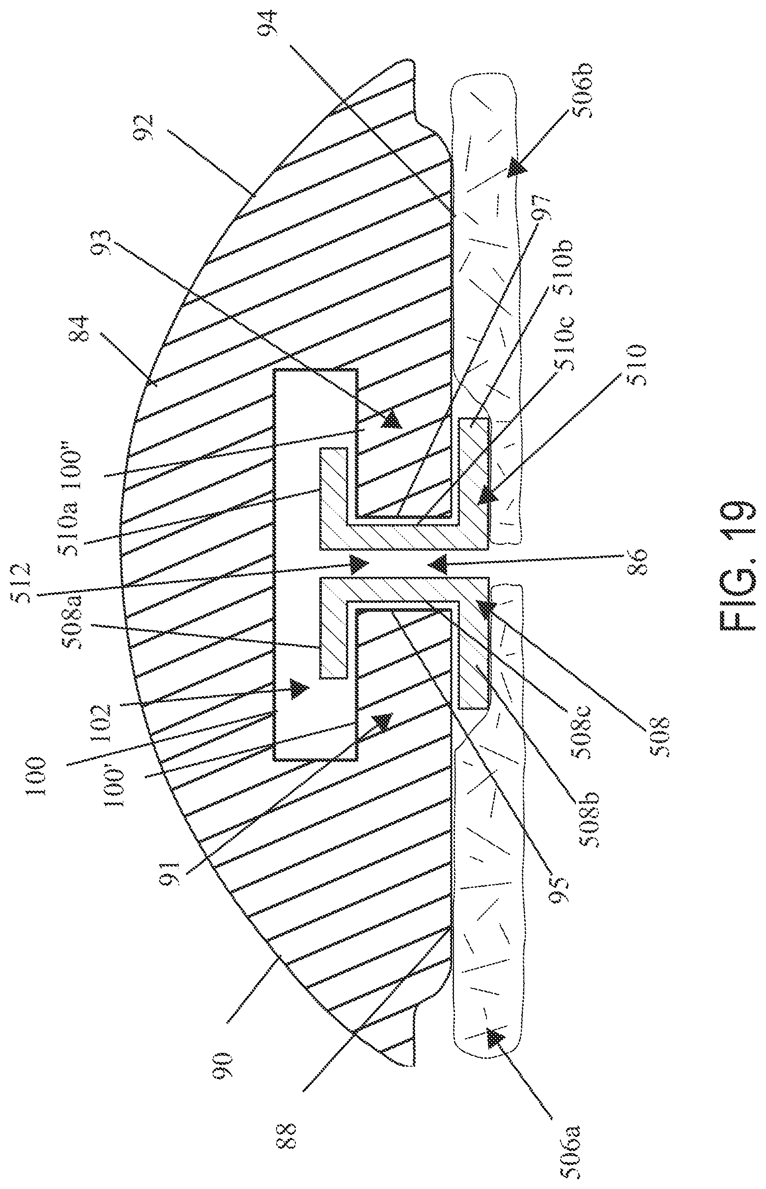 Patent US12496067 Figure 17 – Implantable adjunct with density gradients