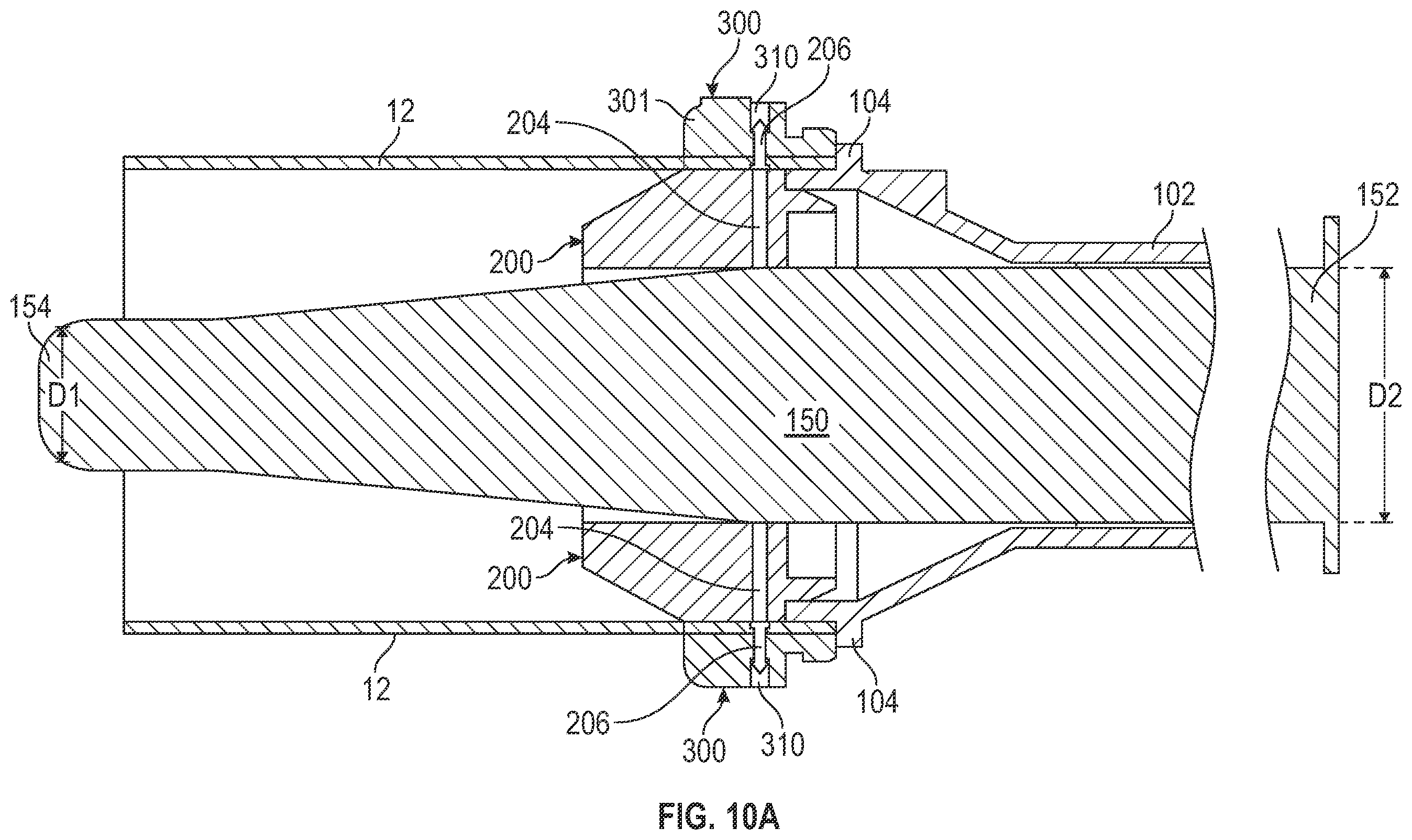 Patent US12496068 Figure 6 – Anastomotic coupler