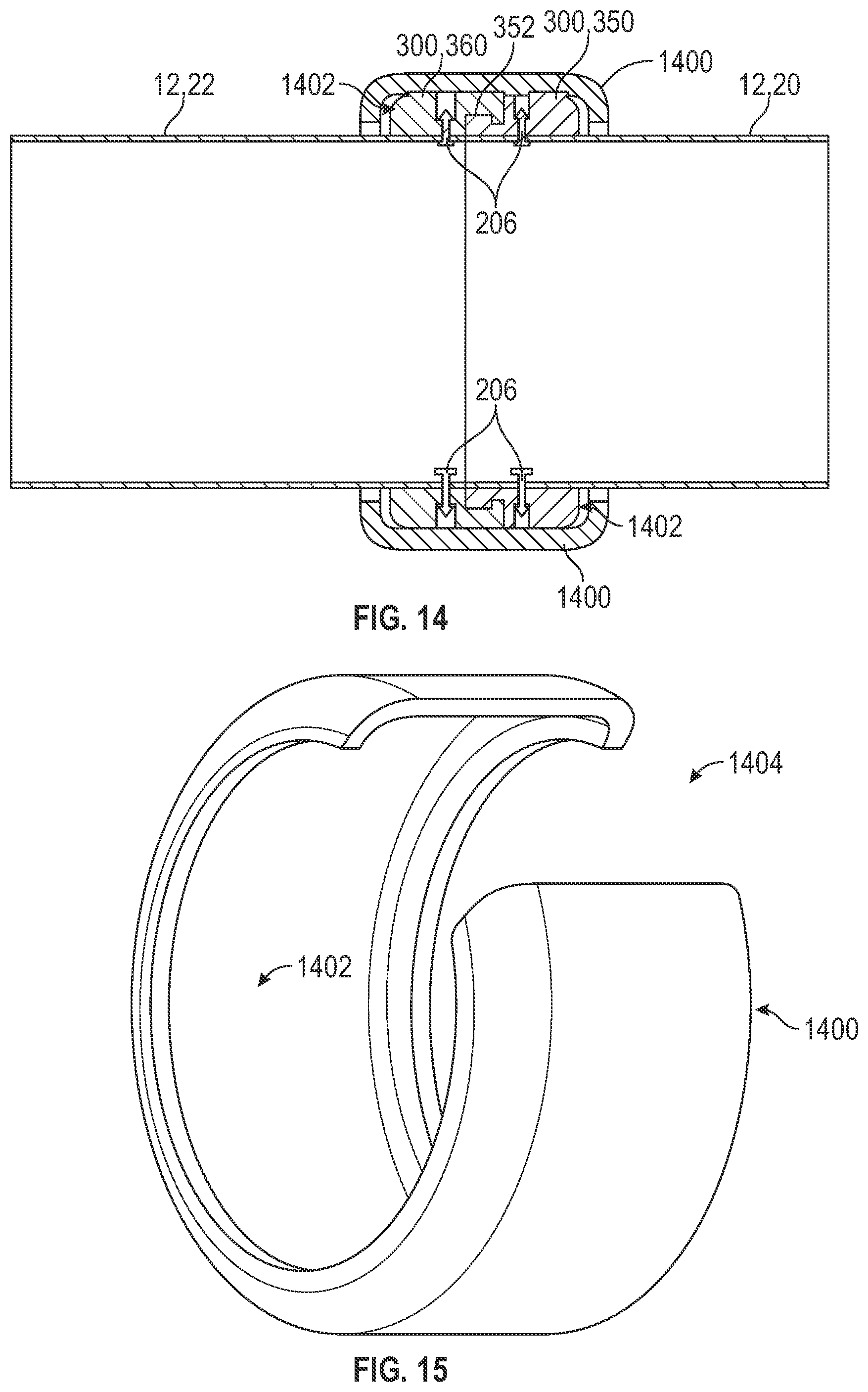 Patent US12496068 Figure 9 – Anastomotic coupler