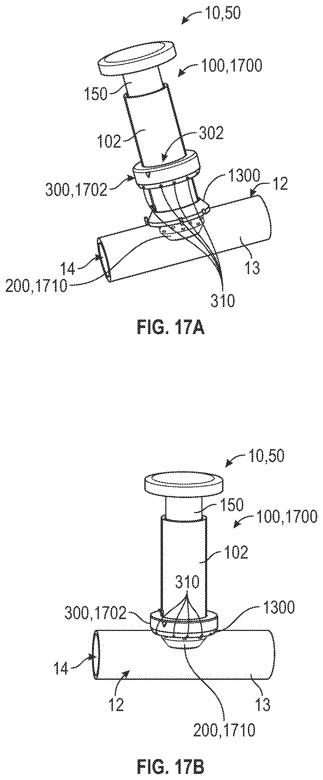 Patent US12496068 Figure 11 – Anastomotic coupler
