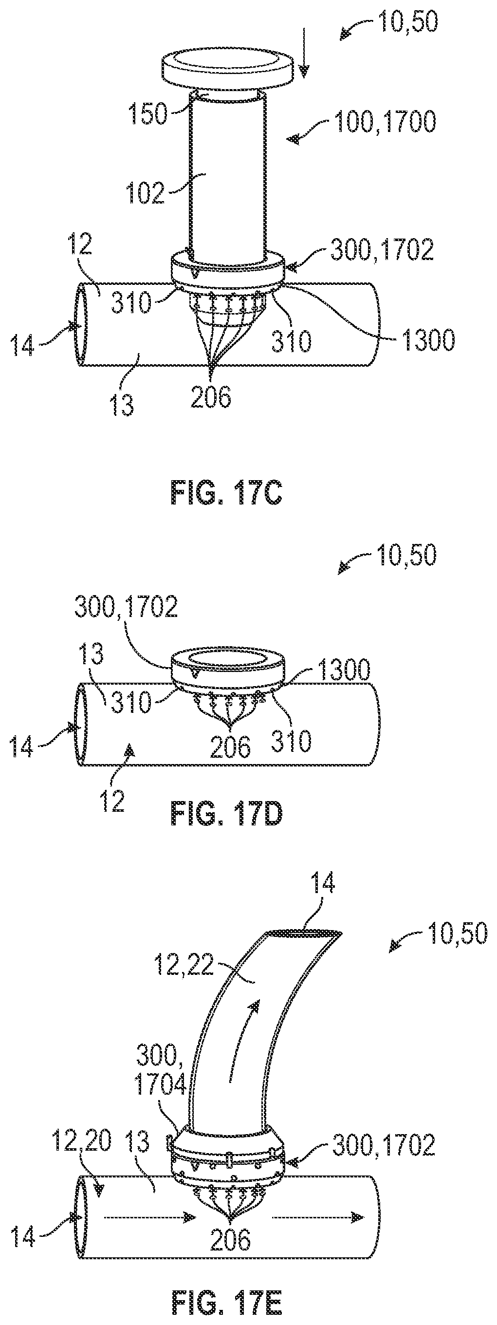 Patent US12496068 Figure 12 – Anastomotic coupler