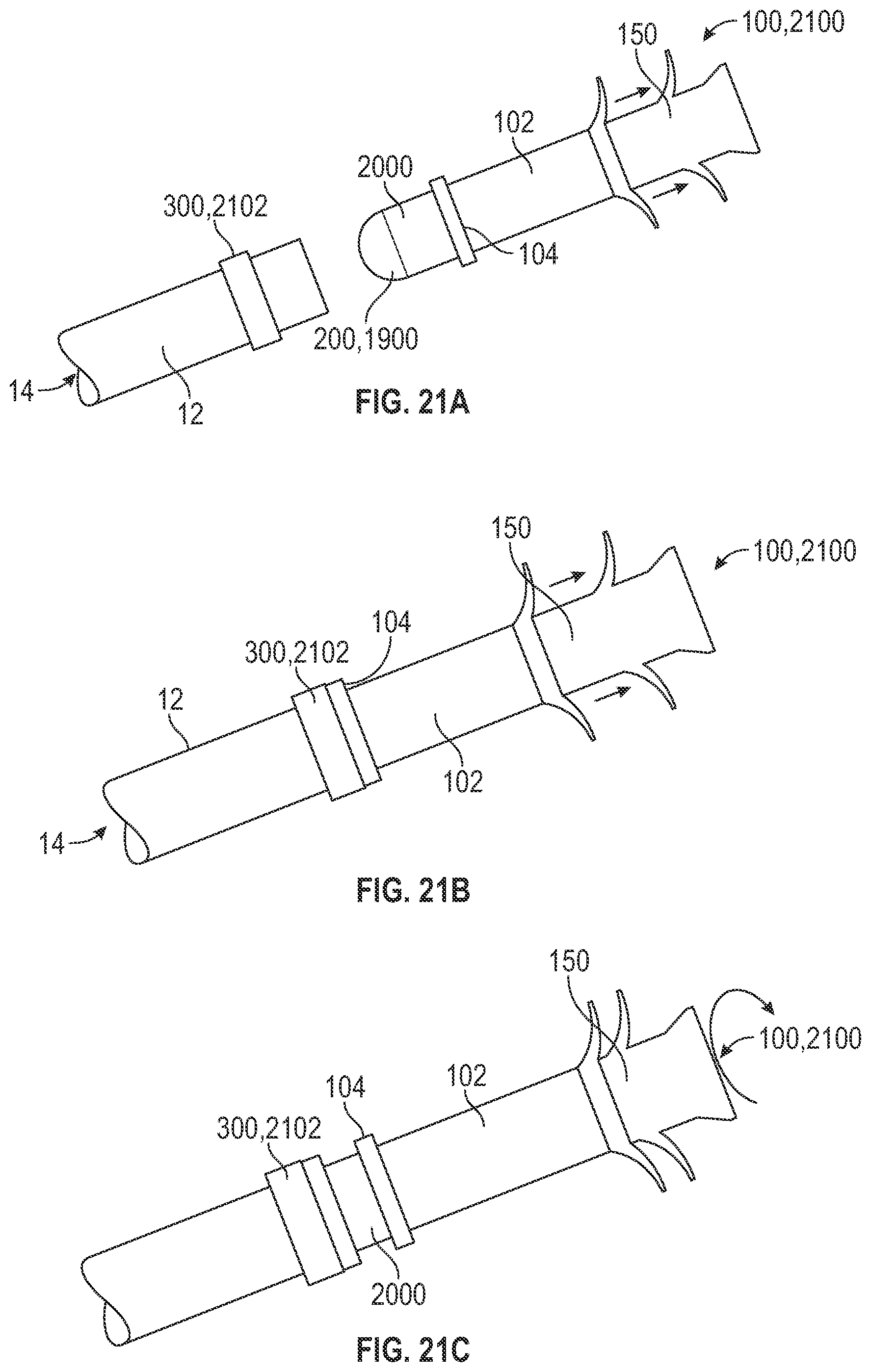 Patent US12496068 Figure 14 – Anastomotic coupler