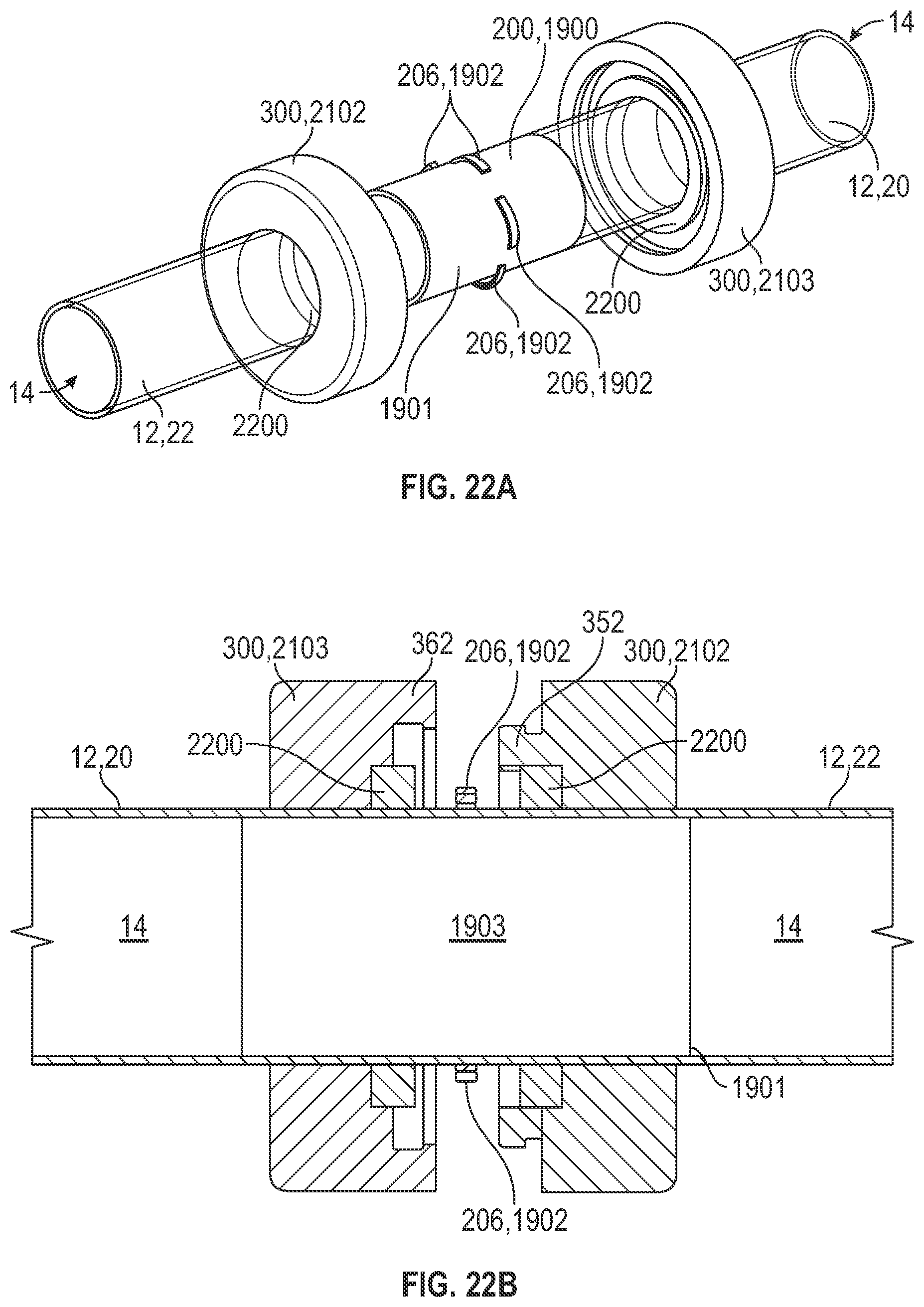 Patent US12496068 Figure 15 – Anastomotic coupler