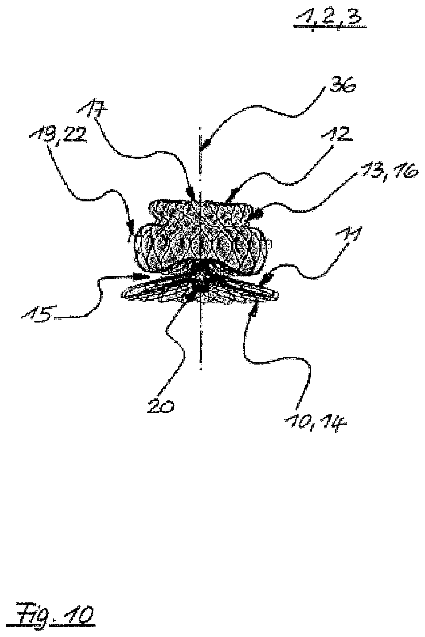 Patent US12496069 Figure 10 – Atrial appendage occluder for closing the left atrial appendage