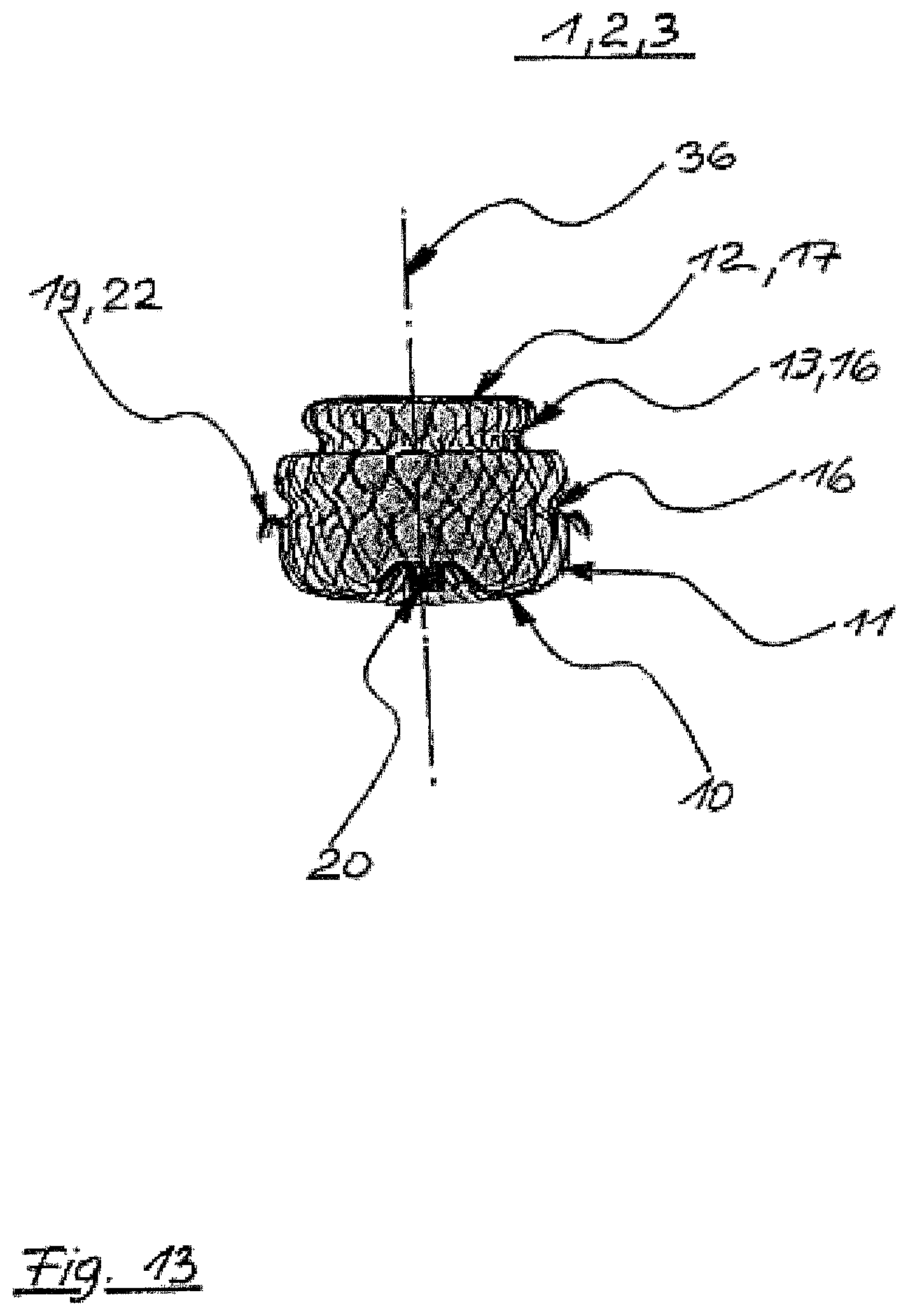 Patent US12496069 Figure 13 – Atrial appendage occluder for closing the left atrial appendage