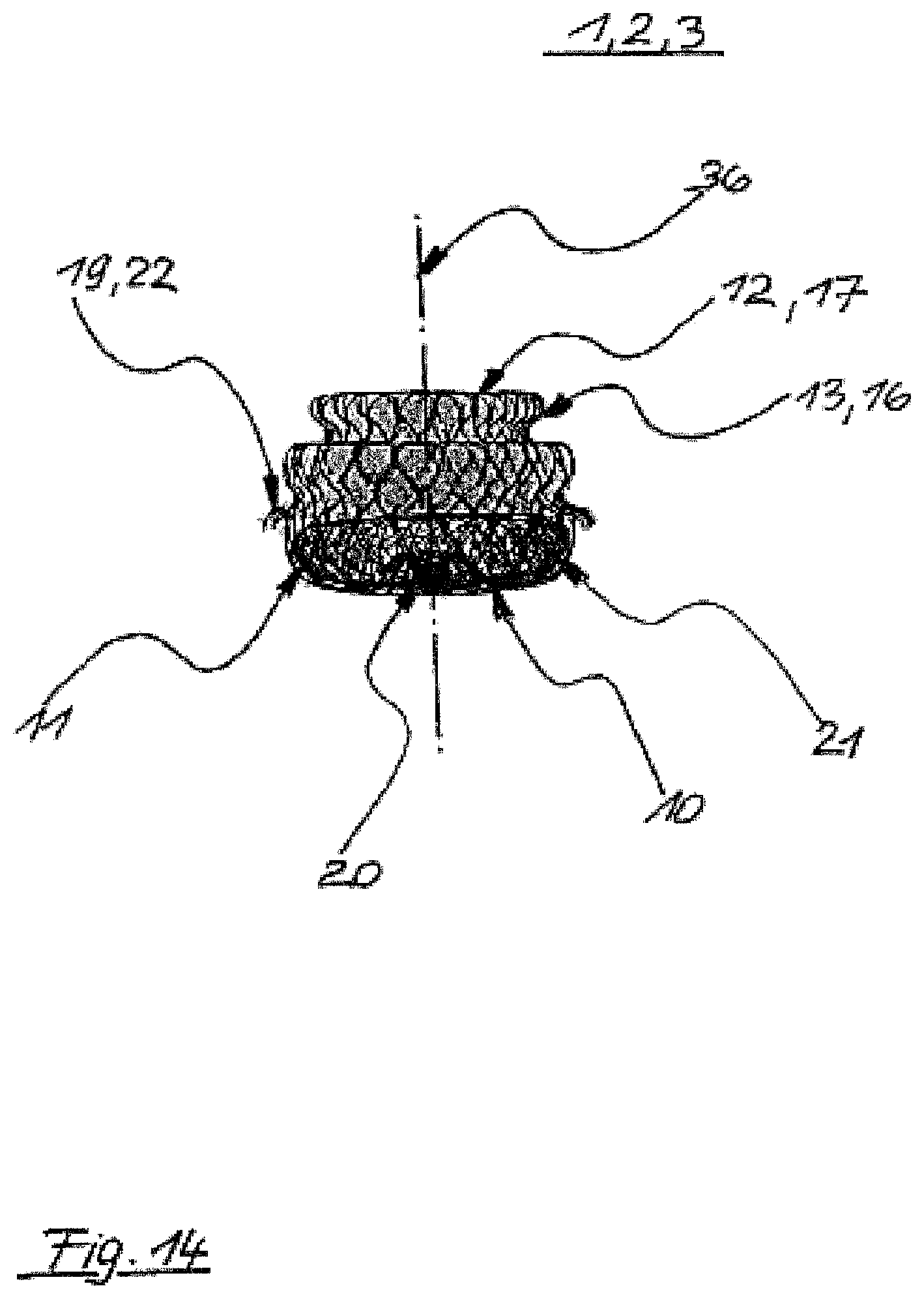 Patent US12496069 Figure 14 – Atrial appendage occluder for closing the left atrial appendage