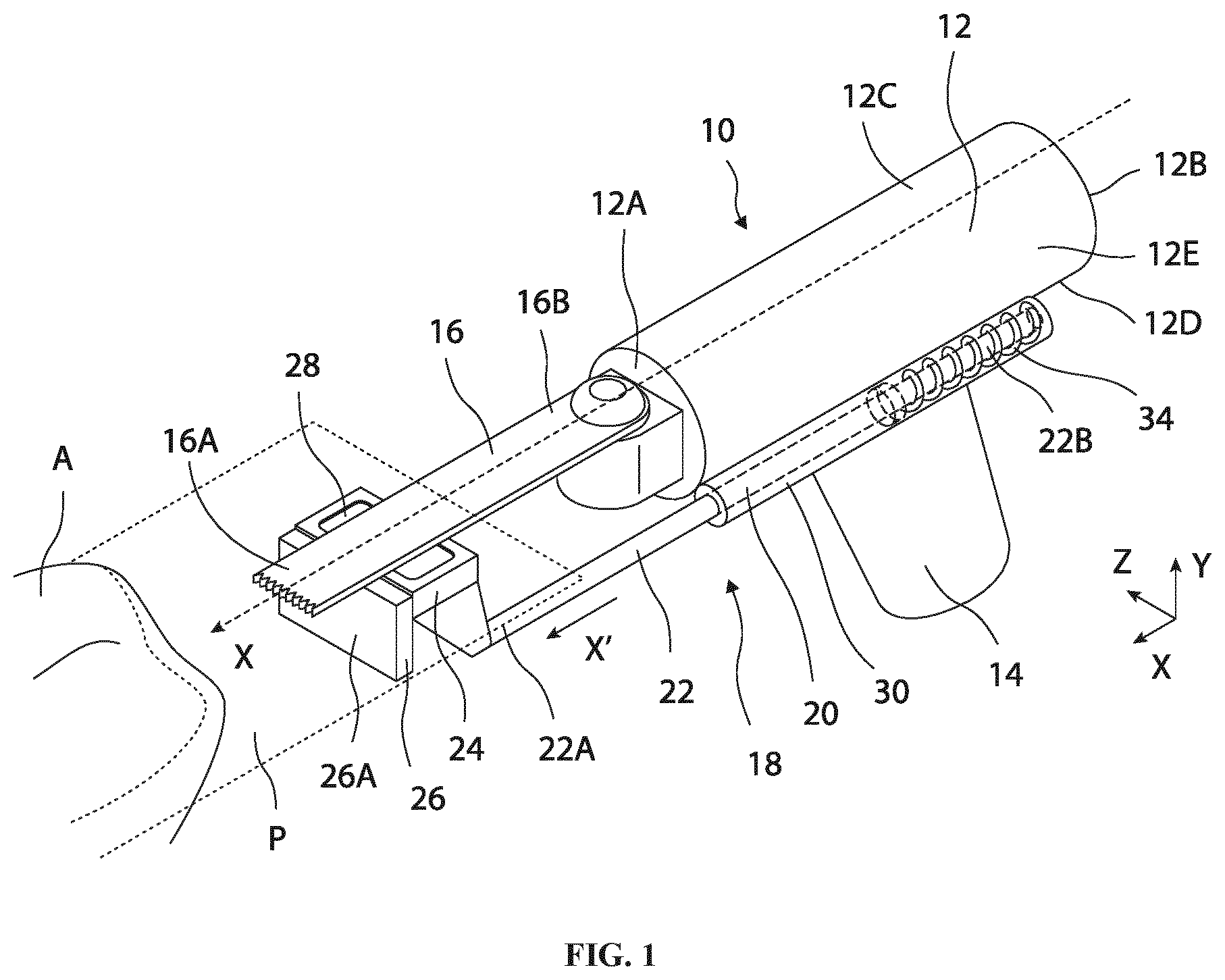 Patent US12496070 Figure 1 – Retractable cutting guide