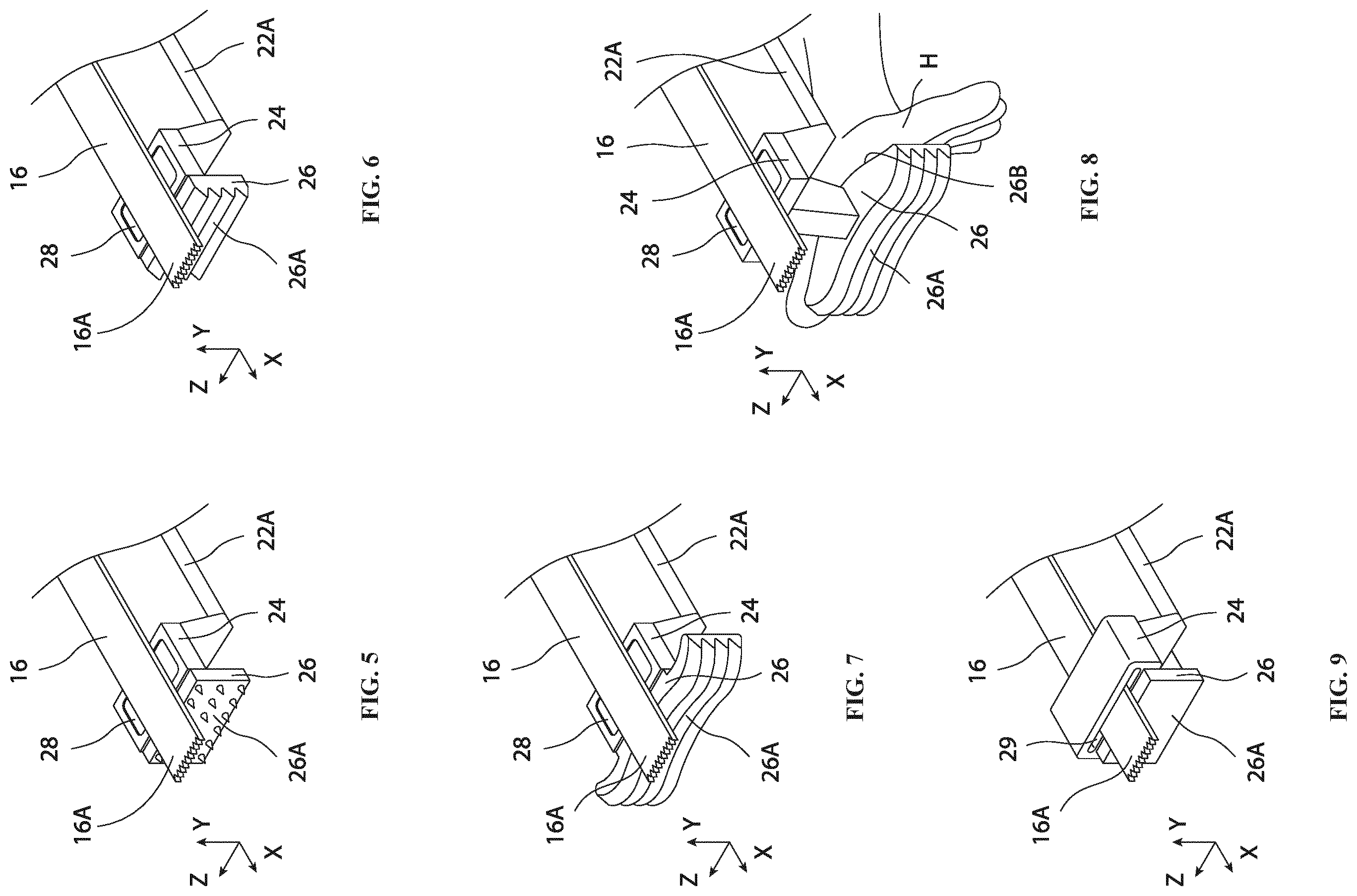 Patent US12496070 Figure 4 – Retractable cutting guide