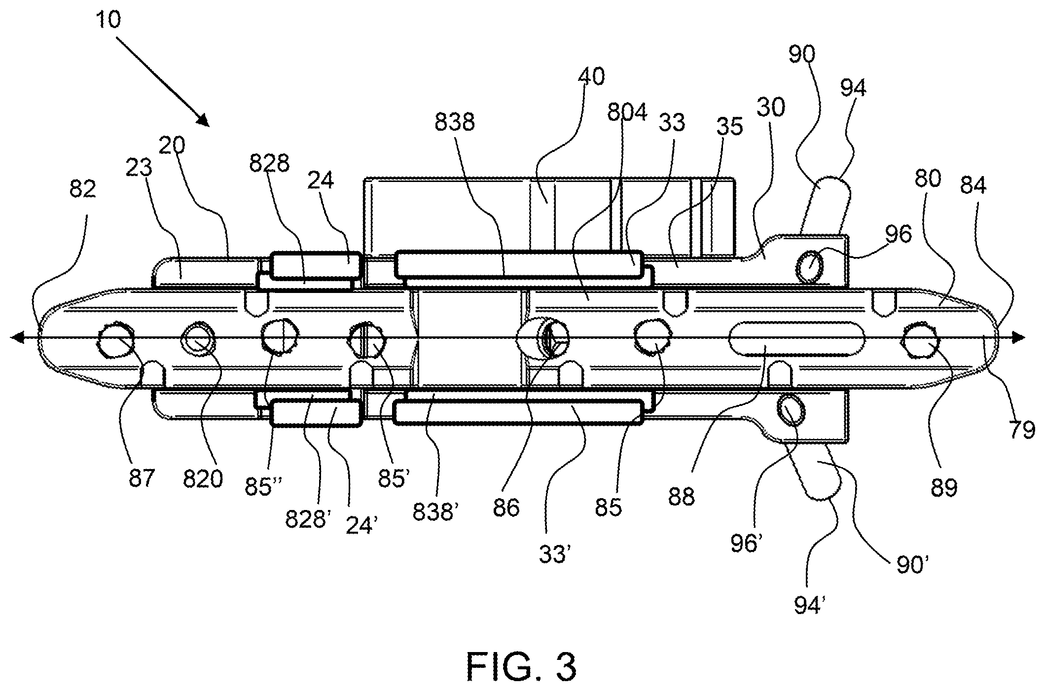 Patent US12496071 Figure 2 – Bone shortening osteotomy apparatus