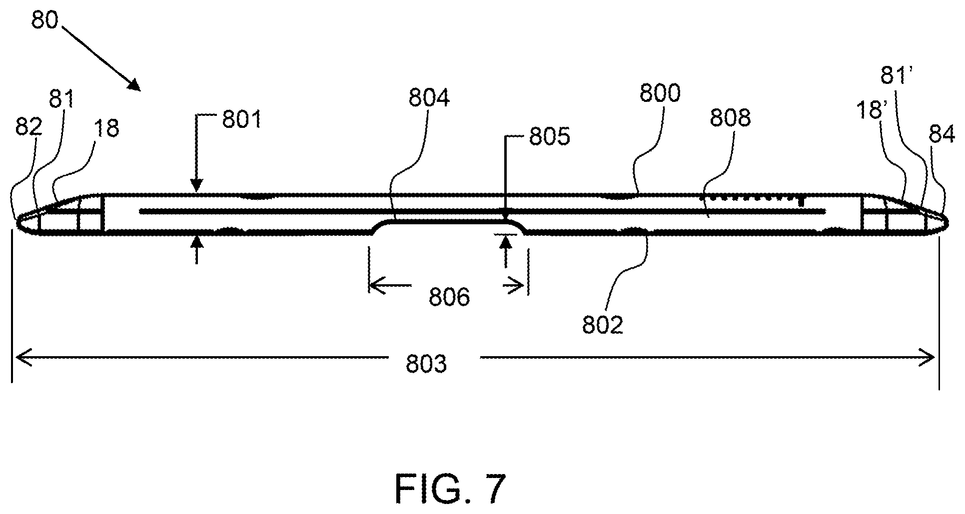 Patent US12496071 Figure 5 – Bone shortening osteotomy apparatus
