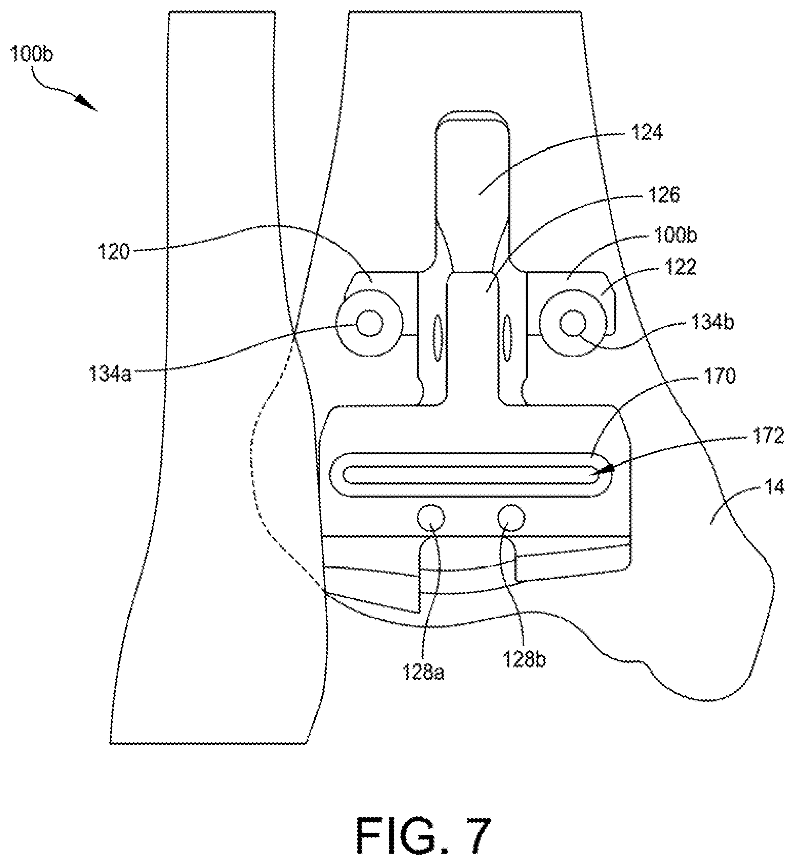 Patent US12496072 Figure 7 – Multi-modal patient-specific surgical guides