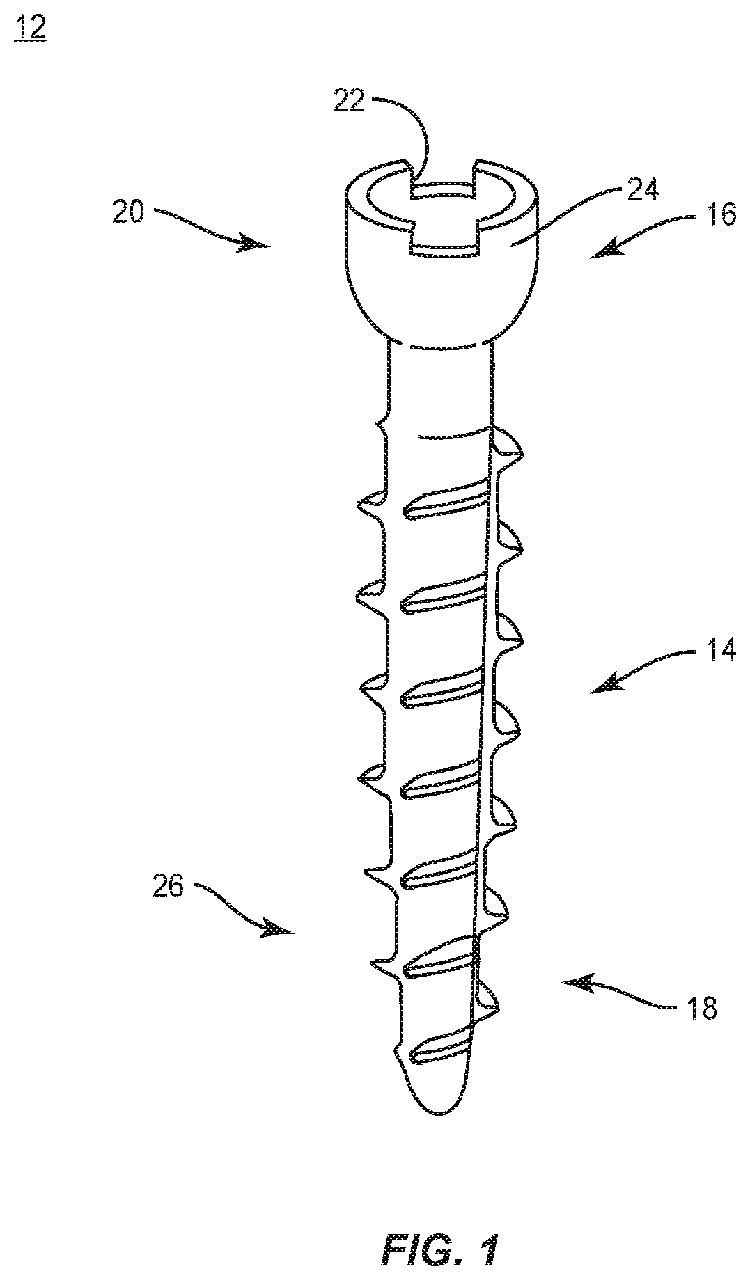 Patent US12496073 — Surgical implant system and methods of use — Figure 1