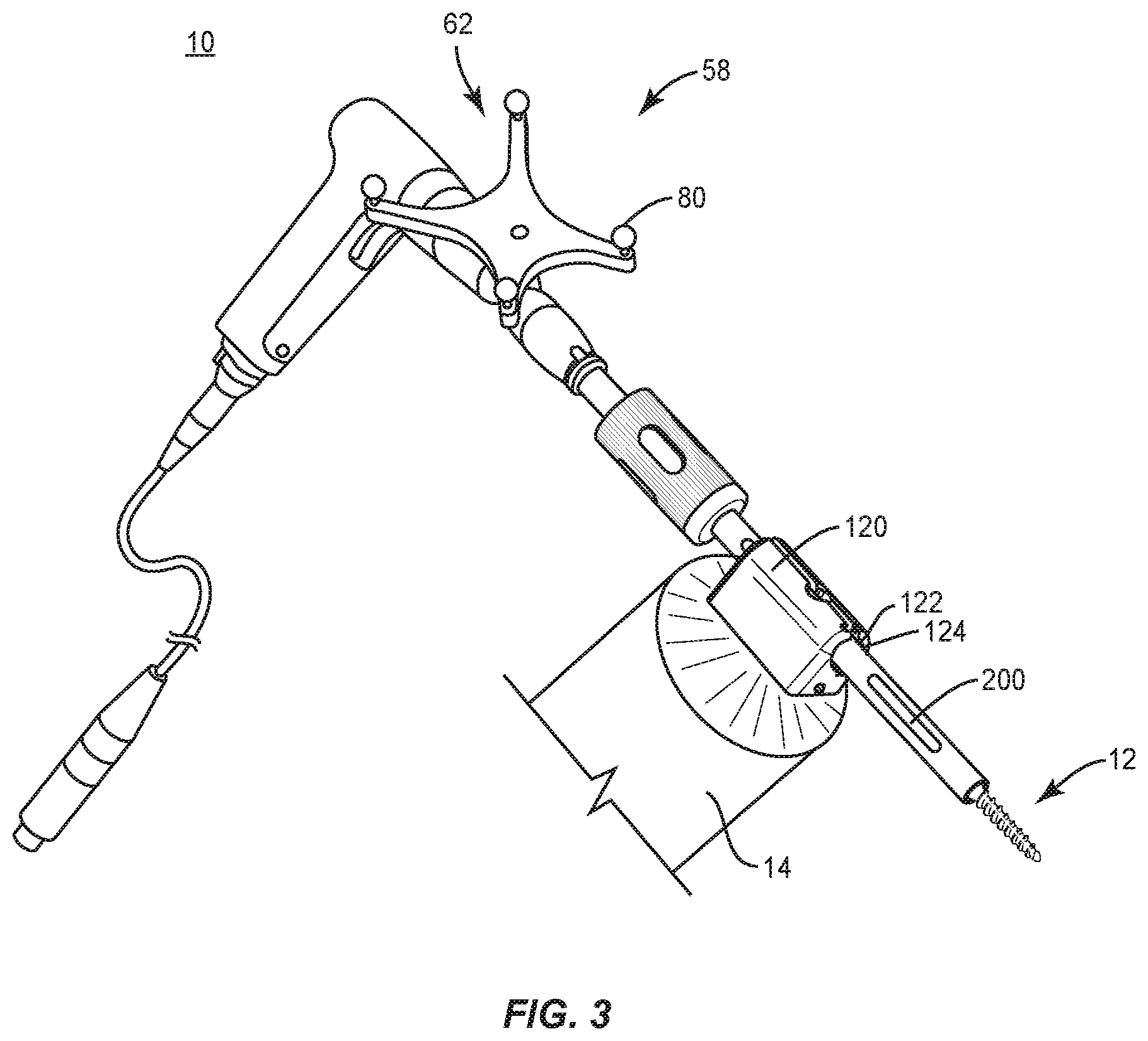 Patent US12496073 Figure 3 – Surgical implant system and methods of use
