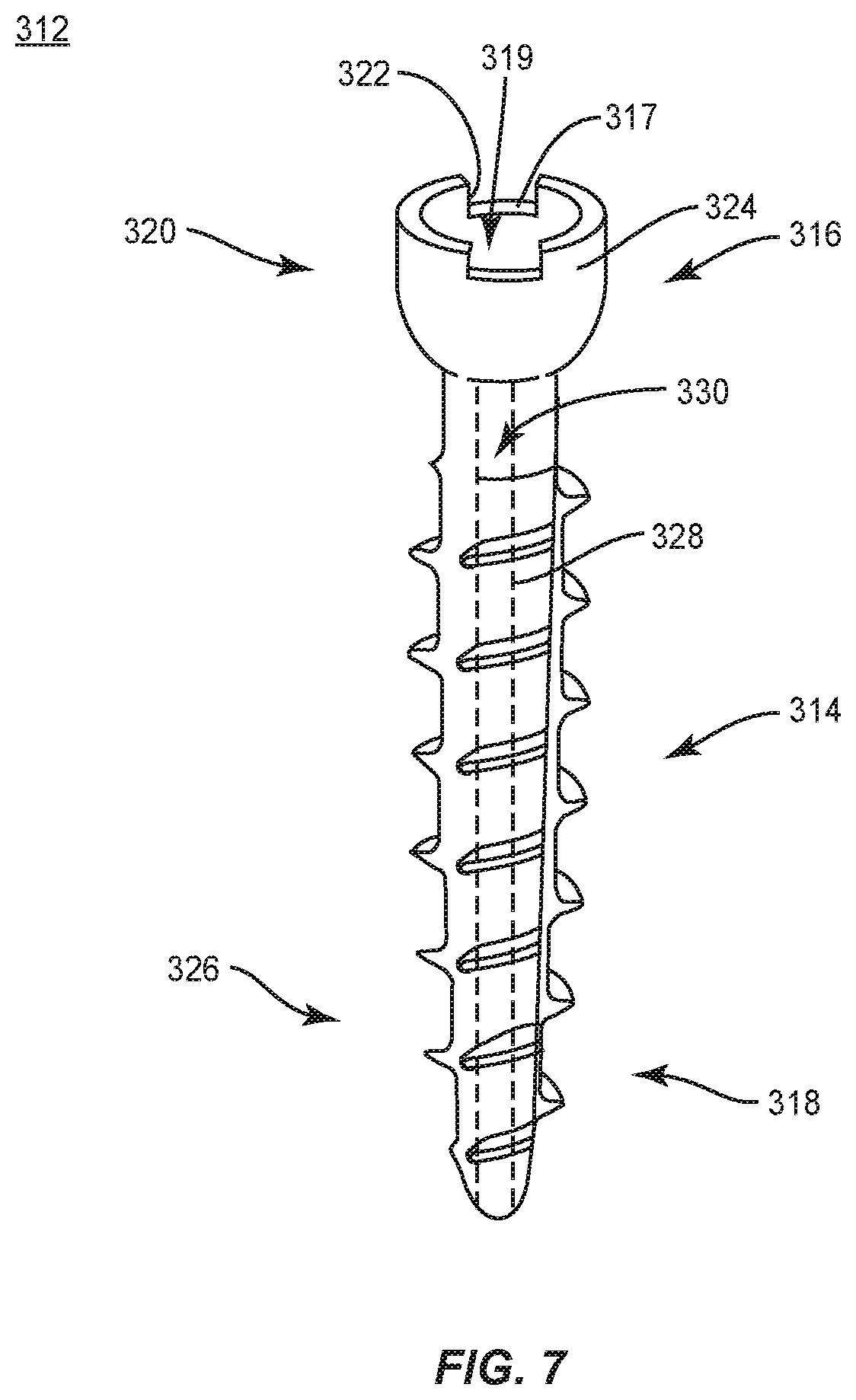 Patent US12496073 Figure 7 – Surgical implant system and methods of use