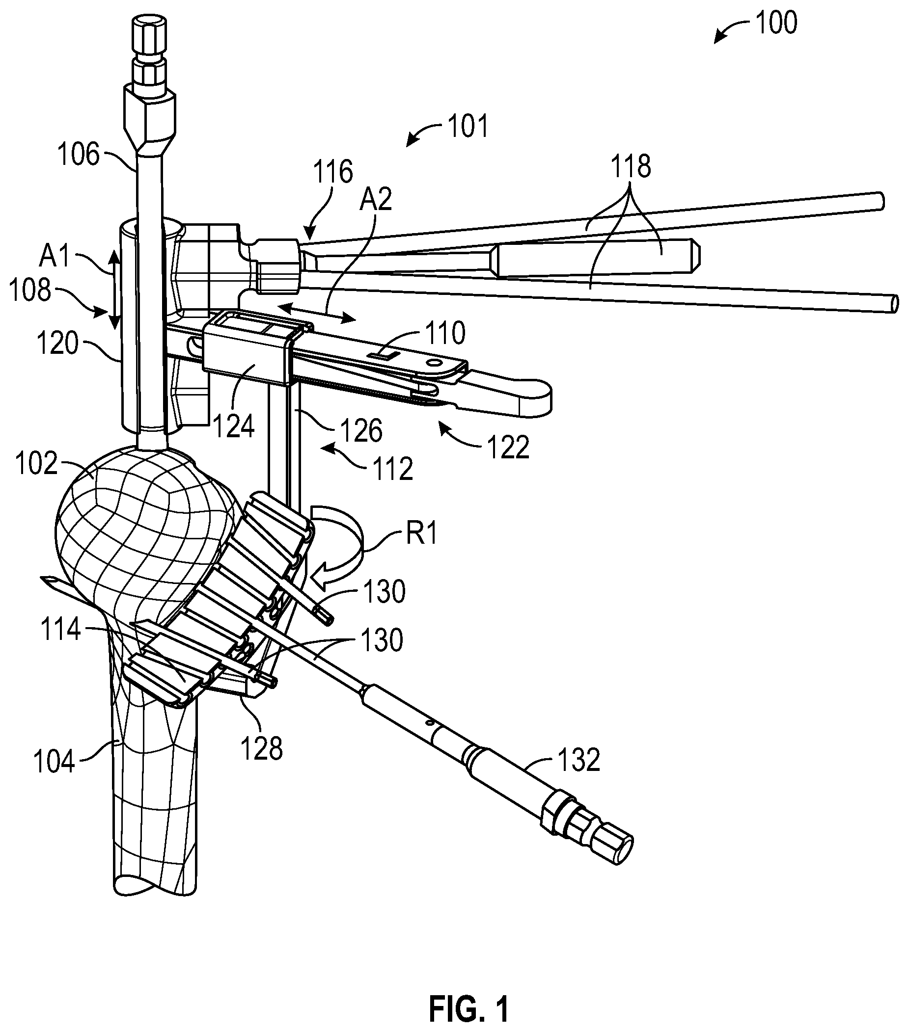 Patent US12496074 Figure 1 – Instruments and systems including a humeral cut guide assembly for an orthopedic shoulder replacement