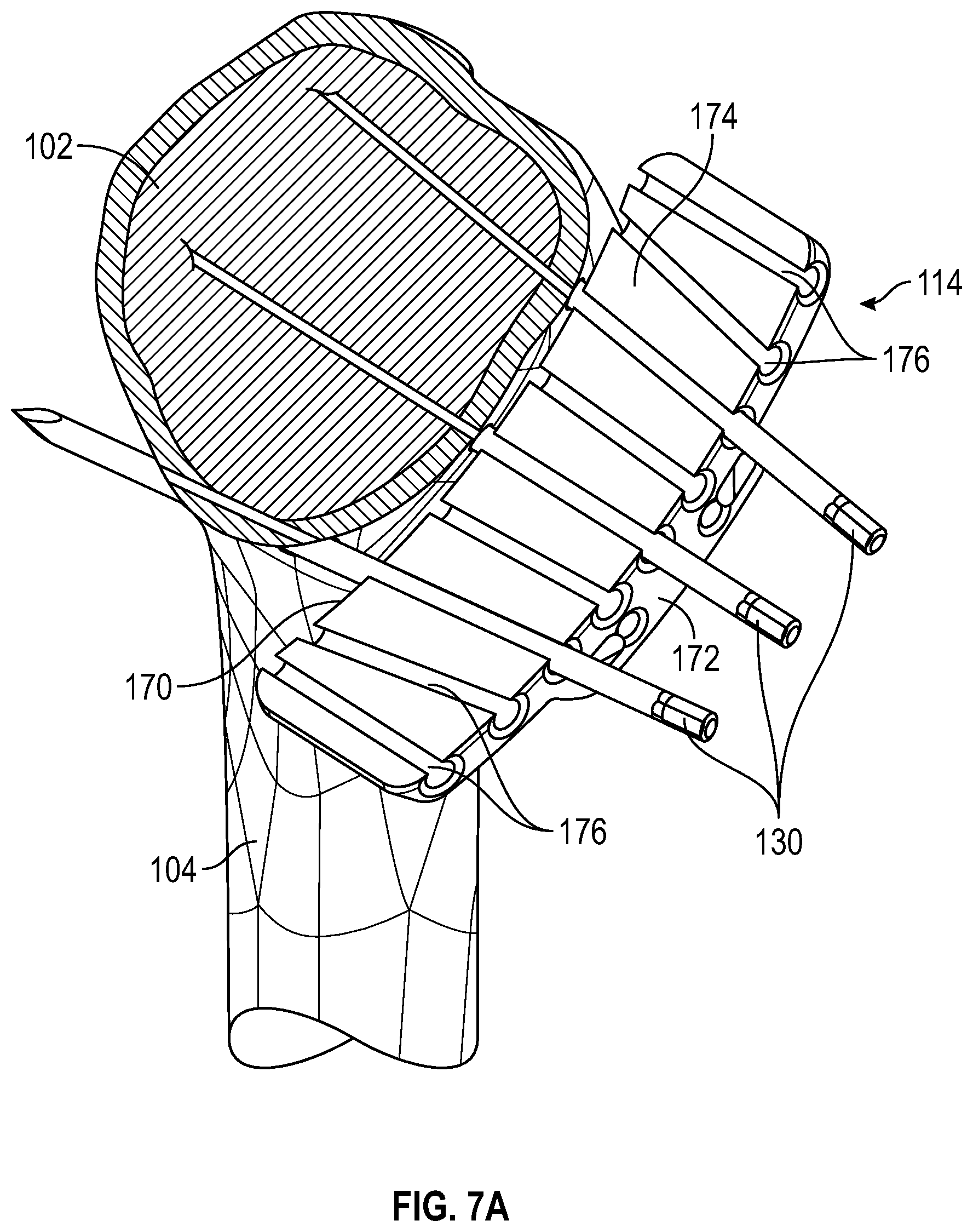 Patent US12496074 Figure 9 – Instruments and systems including a humeral cut guide assembly for an orthopedic shoulder replacement