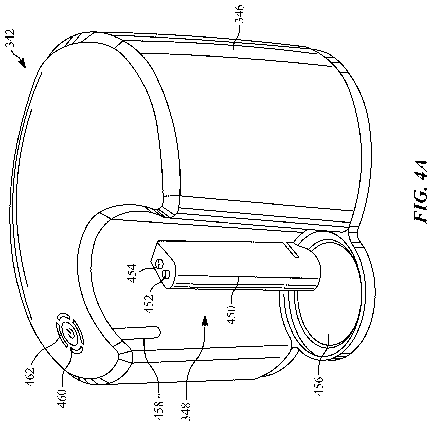 Patent US12496076 Figure 4 – Computer-aided vacuum thrombectomy systems and methods for processing and visualizing thrombectomy procedure analytics