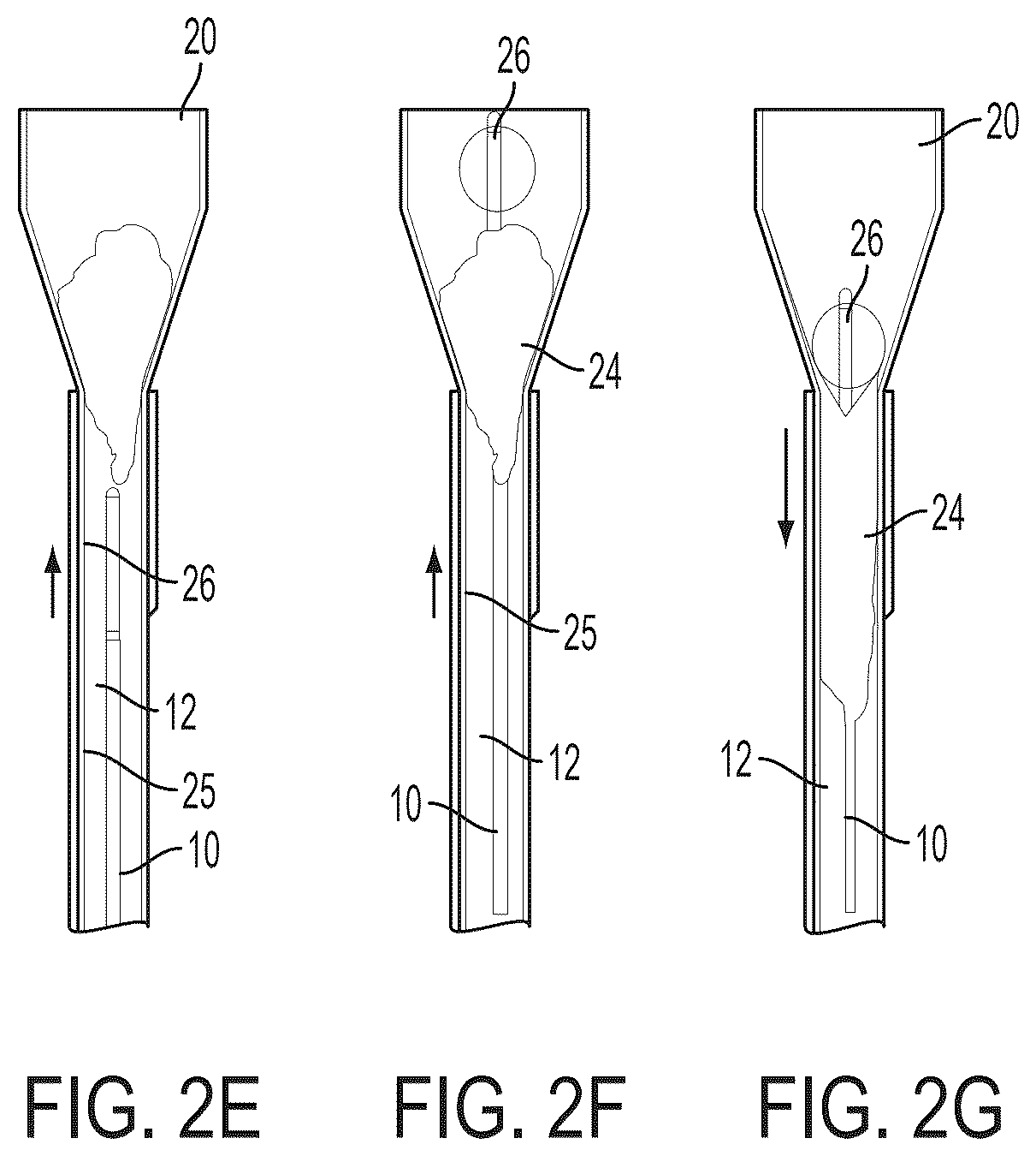 Patent US12496077 Figure 4 – Systems and methods for removing undesirable material within a circulatory system