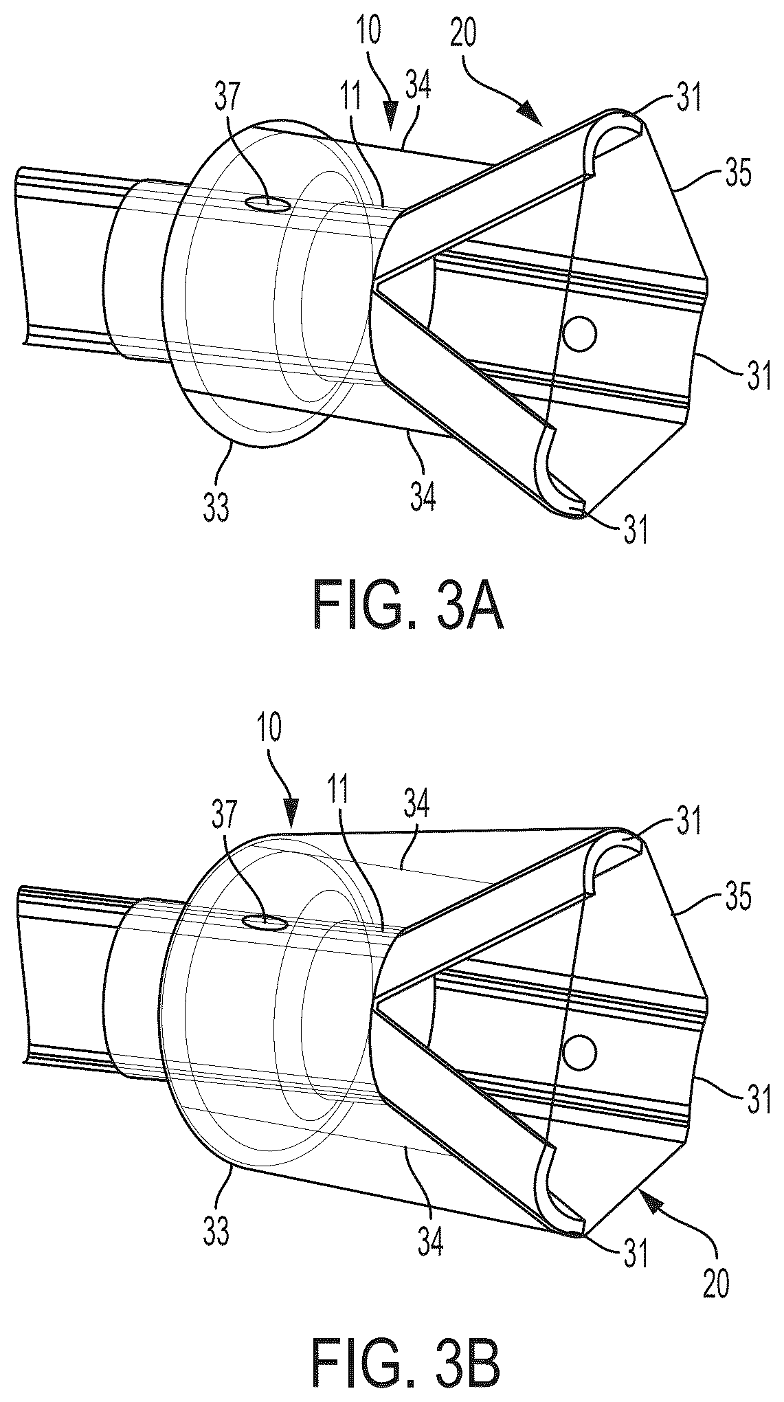 Patent US12496077 Figure 6 – Systems and methods for removing undesirable material within a circulatory system