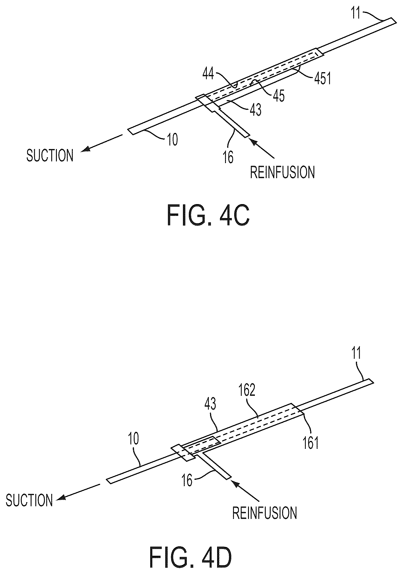 Patent US12496077 Figure 8 – Systems and methods for removing undesirable material within a circulatory system