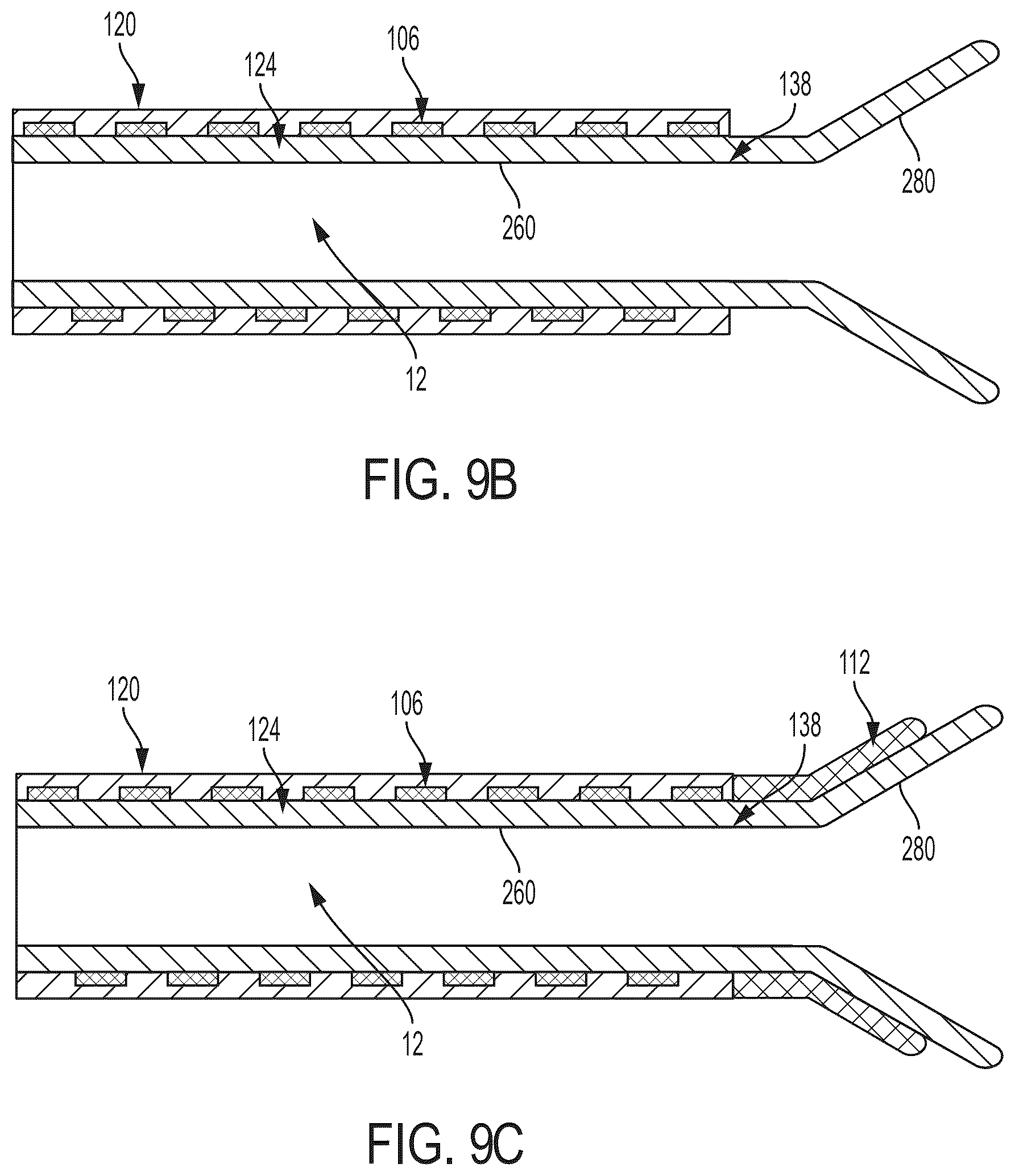 Patent US12496077 Figure 14 – Systems and methods for removing undesirable material within a circulatory system