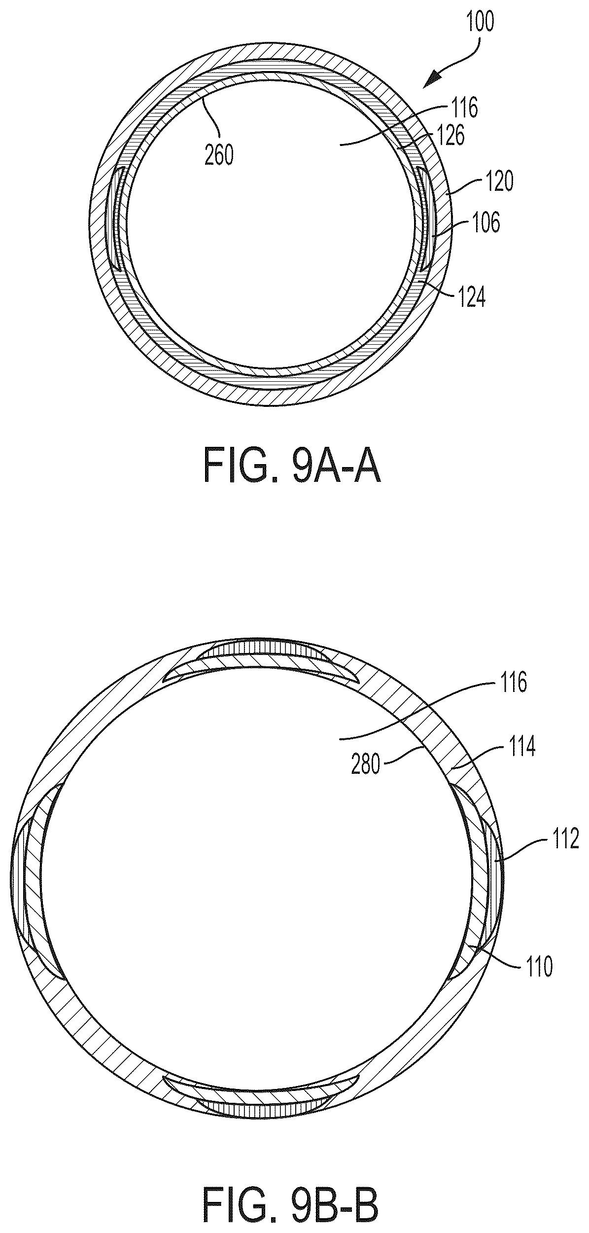 Patent US12496077 Figure 16 – Systems and methods for removing undesirable material within a circulatory system