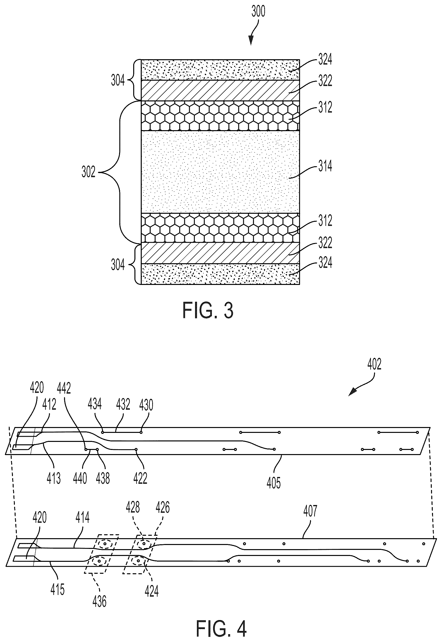 Patent US12496078 Figure 3 – Lithotripsy catheters having electrodes formed in metallization layers