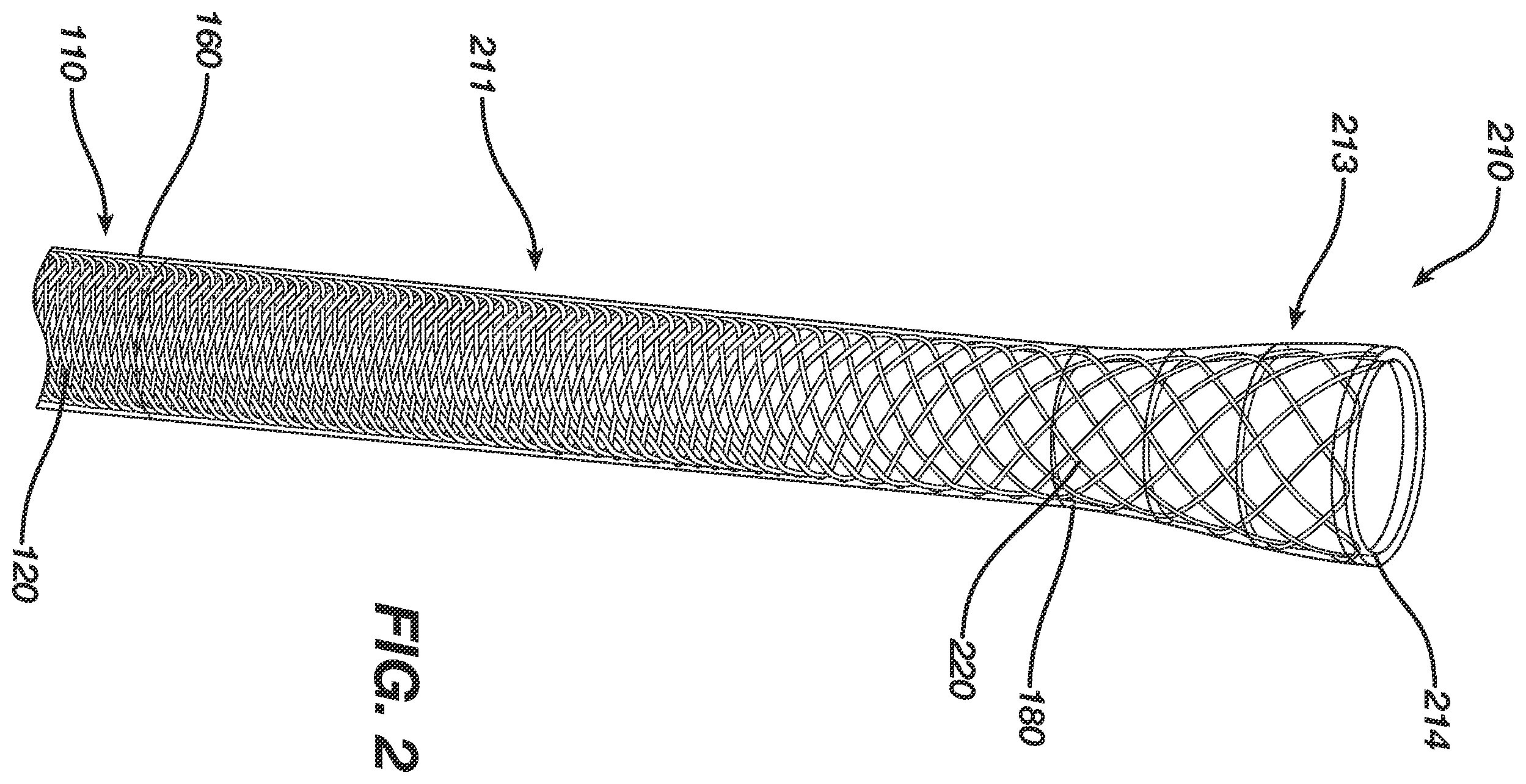 Patent US12496080 Figure 2 – Super-bore catheter with braid supported flared tip