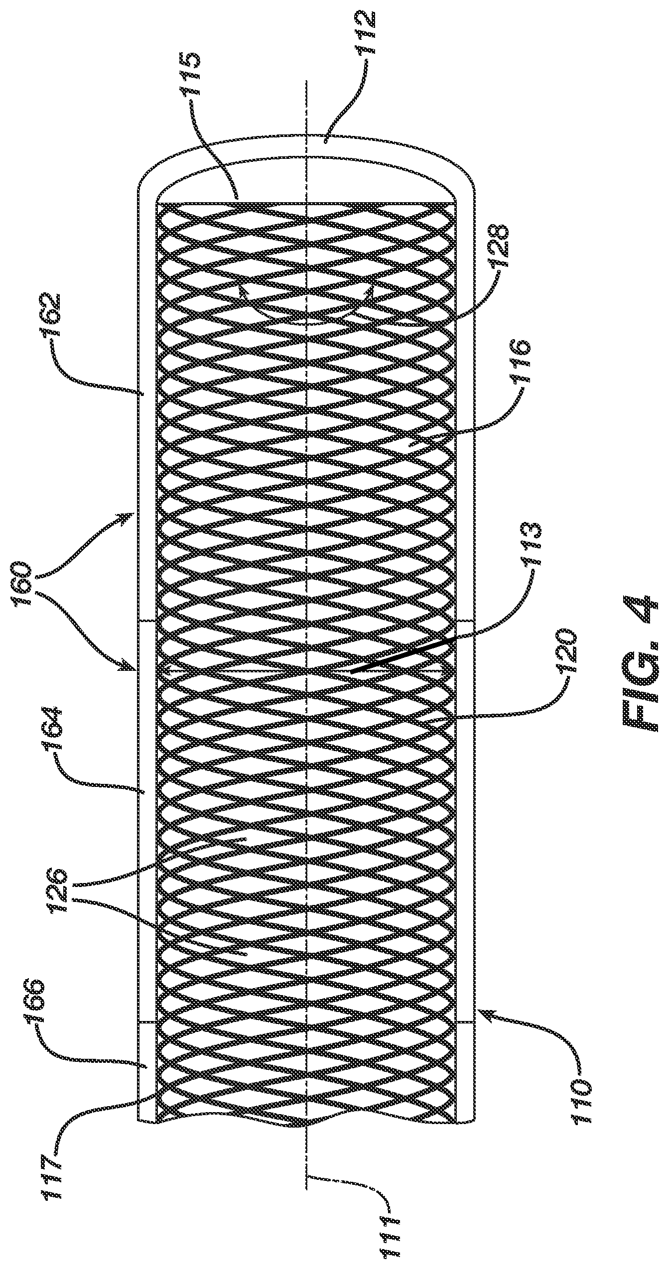 Patent US12496080 Figure 4 – Super-bore catheter with braid supported flared tip