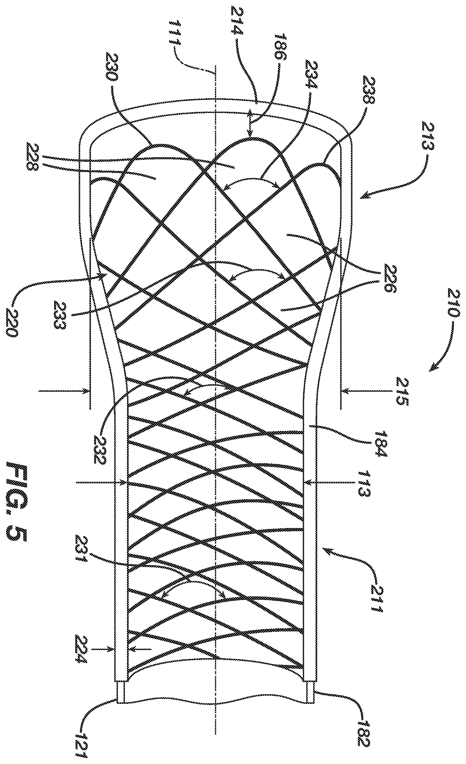Patent US12496080 Figure 5 – Super-bore catheter with braid supported flared tip