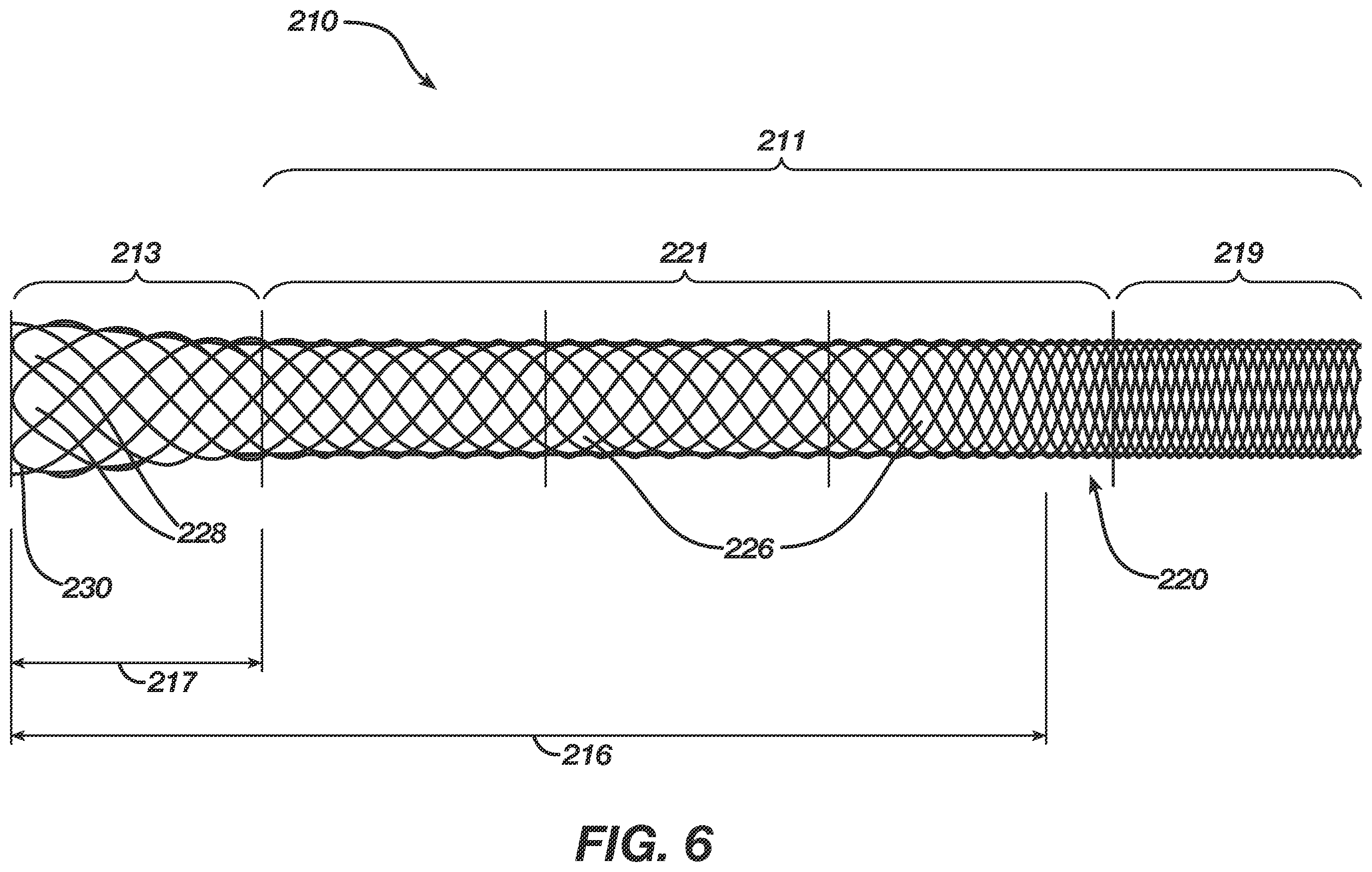 Patent US12496080 Figure 6 – Super-bore catheter with braid supported flared tip