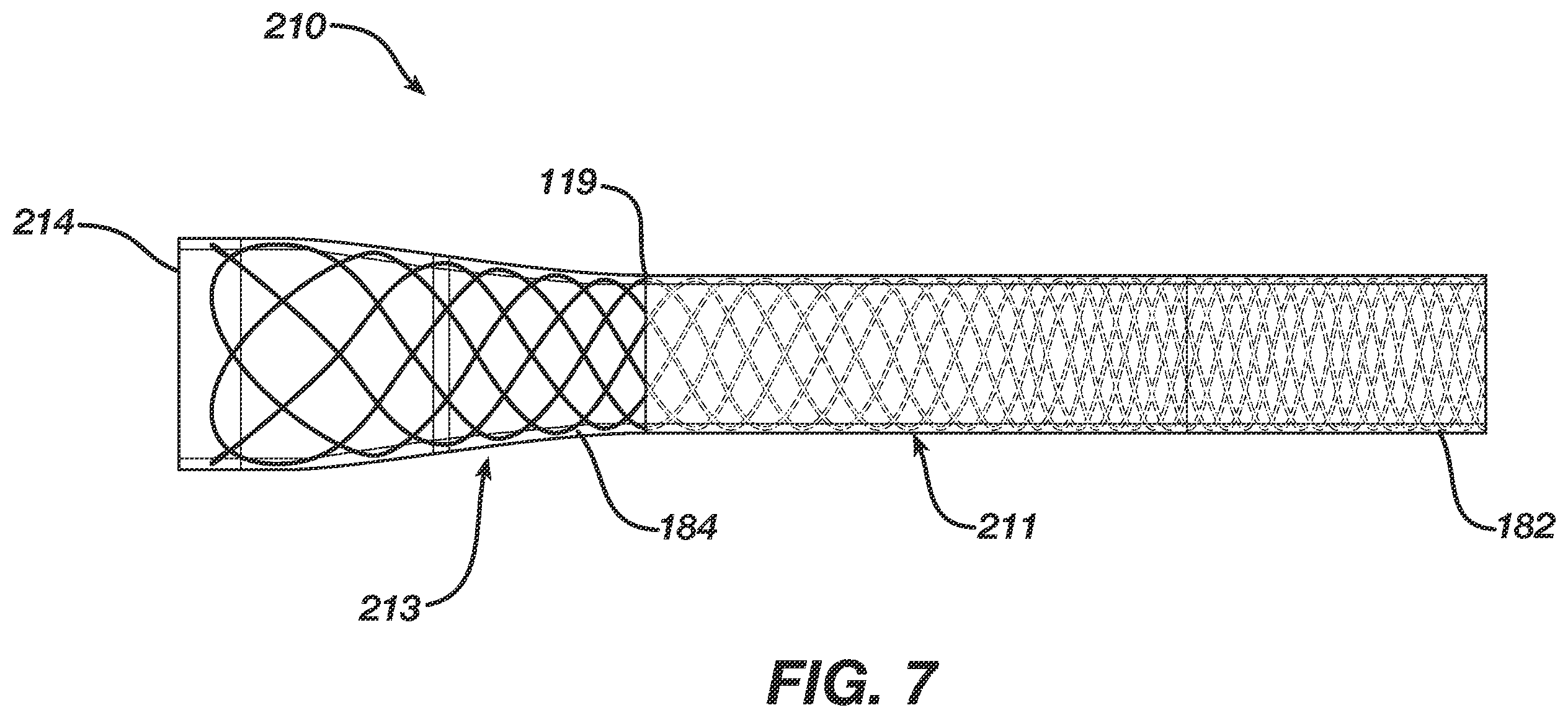 Patent US12496080 Figure 7 – Super-bore catheter with braid supported flared tip