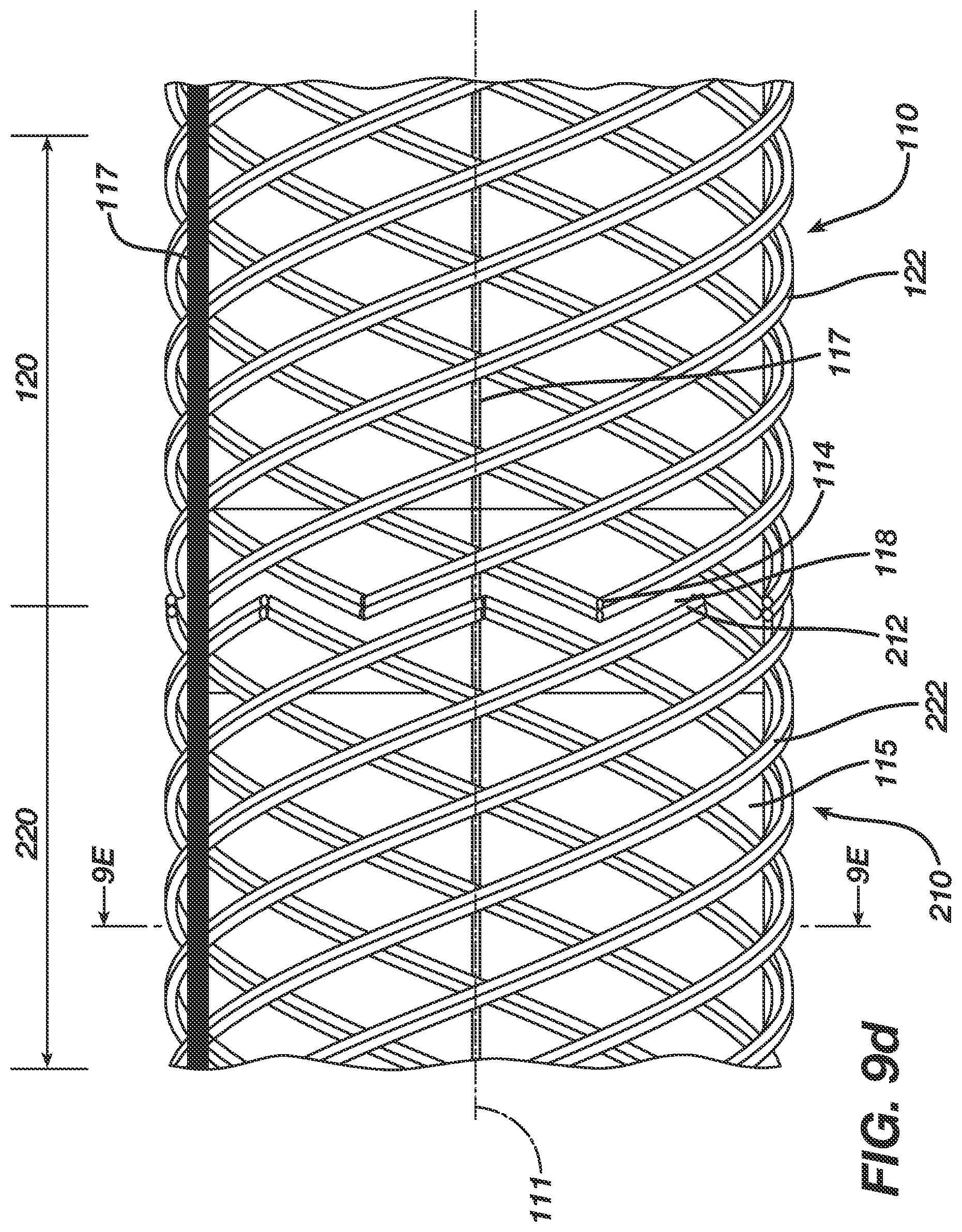 Patent US12496080 Figure 10 – Super-bore catheter with braid supported flared tip