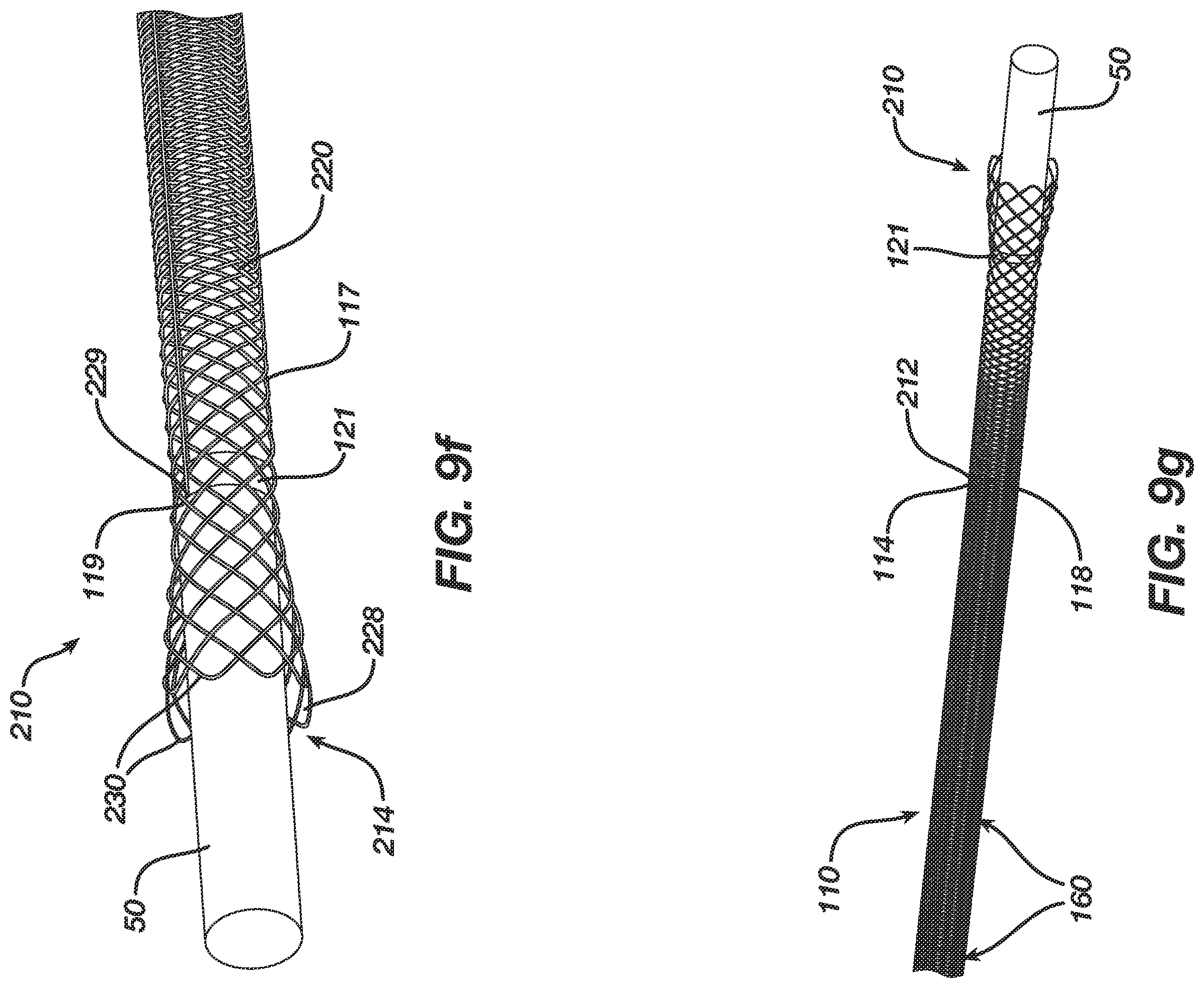 Patent US12496080 Figure 12 – Super-bore catheter with braid supported flared tip