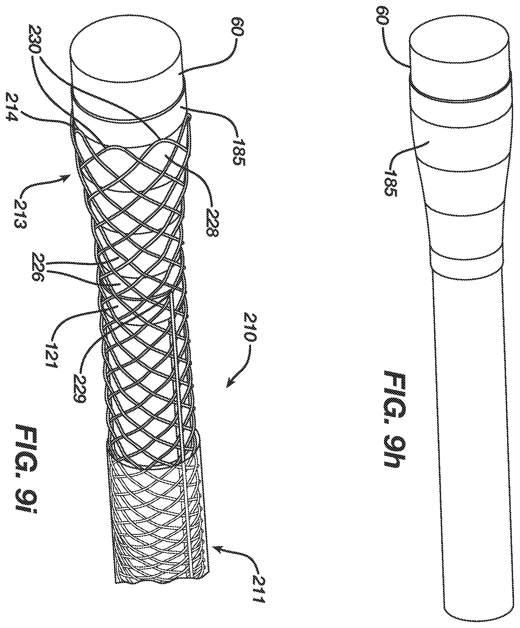 Patent US12496080 Figure 13 – Super-bore catheter with braid supported flared tip