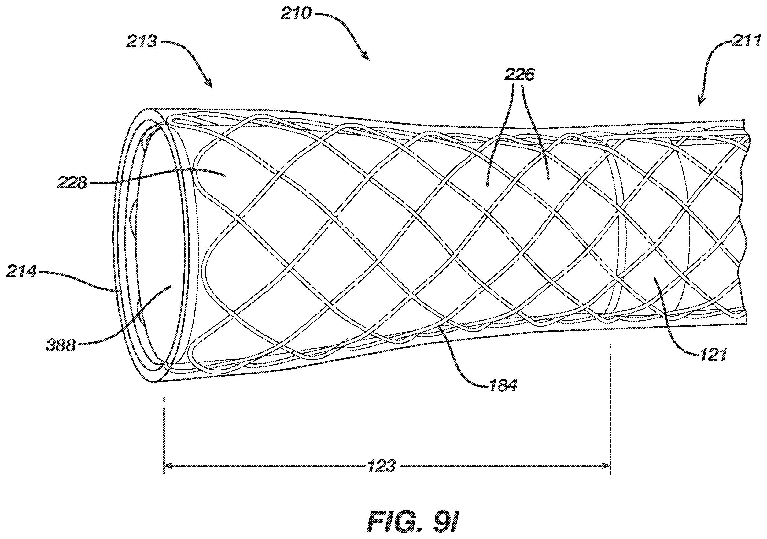 Patent US12496080 Figure 15 – Super-bore catheter with braid supported flared tip