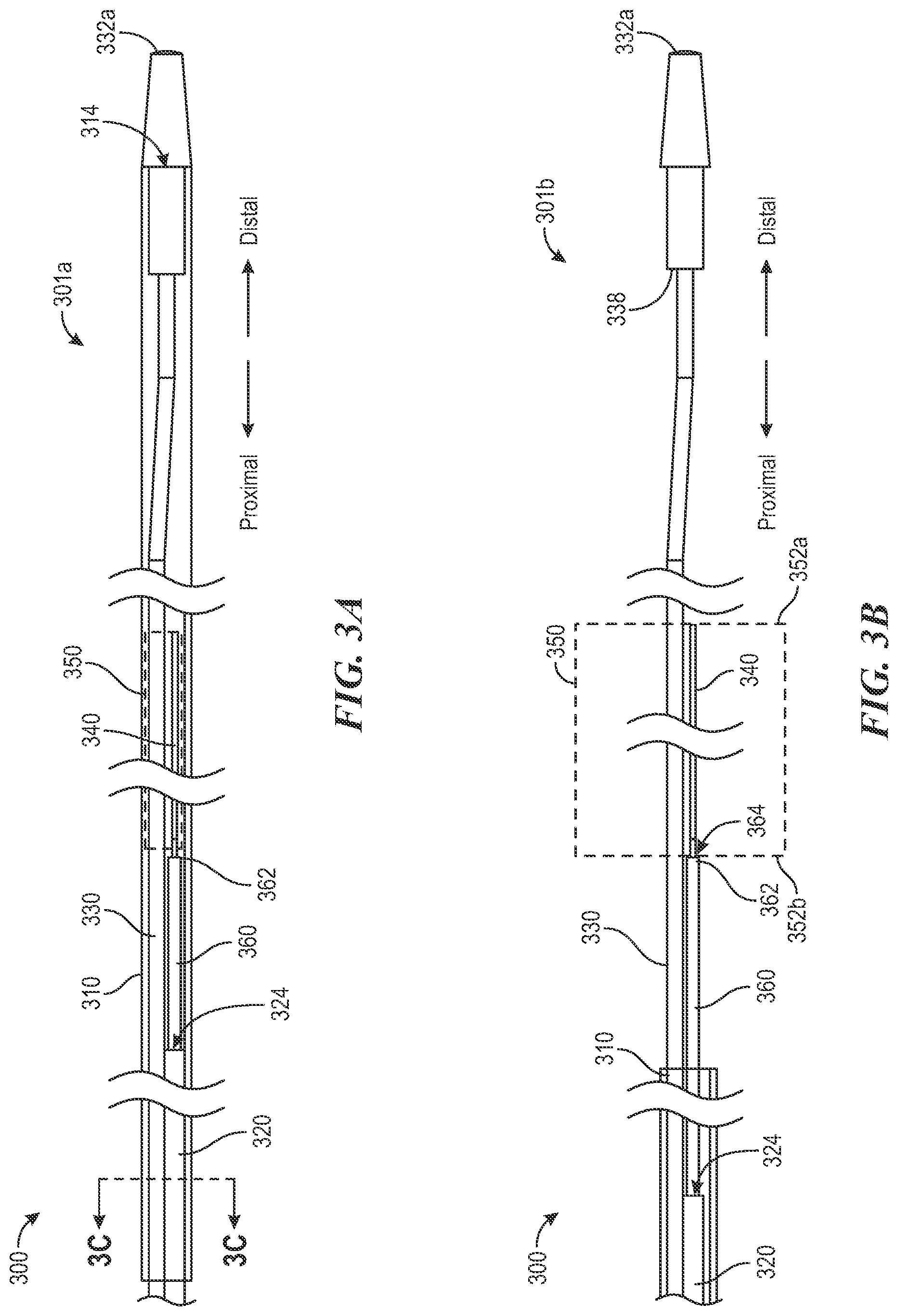 Patent US12496081 Figure 4 – Catheter for use with clot treatment systems