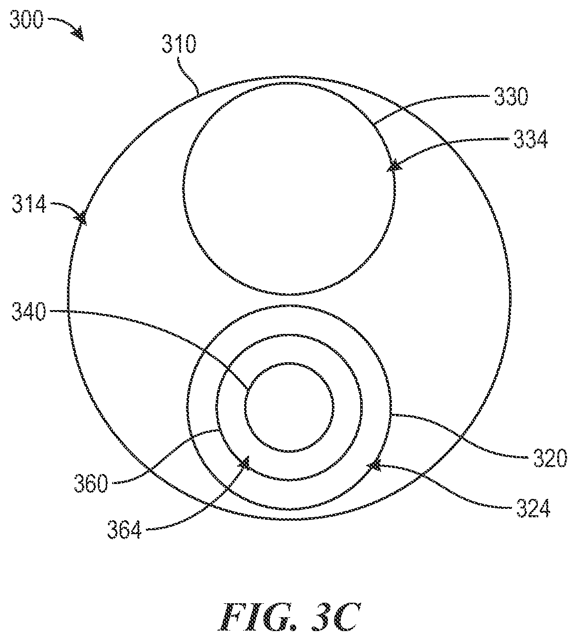 Patent US12496081 Figure 5 – Catheter for use with clot treatment systems