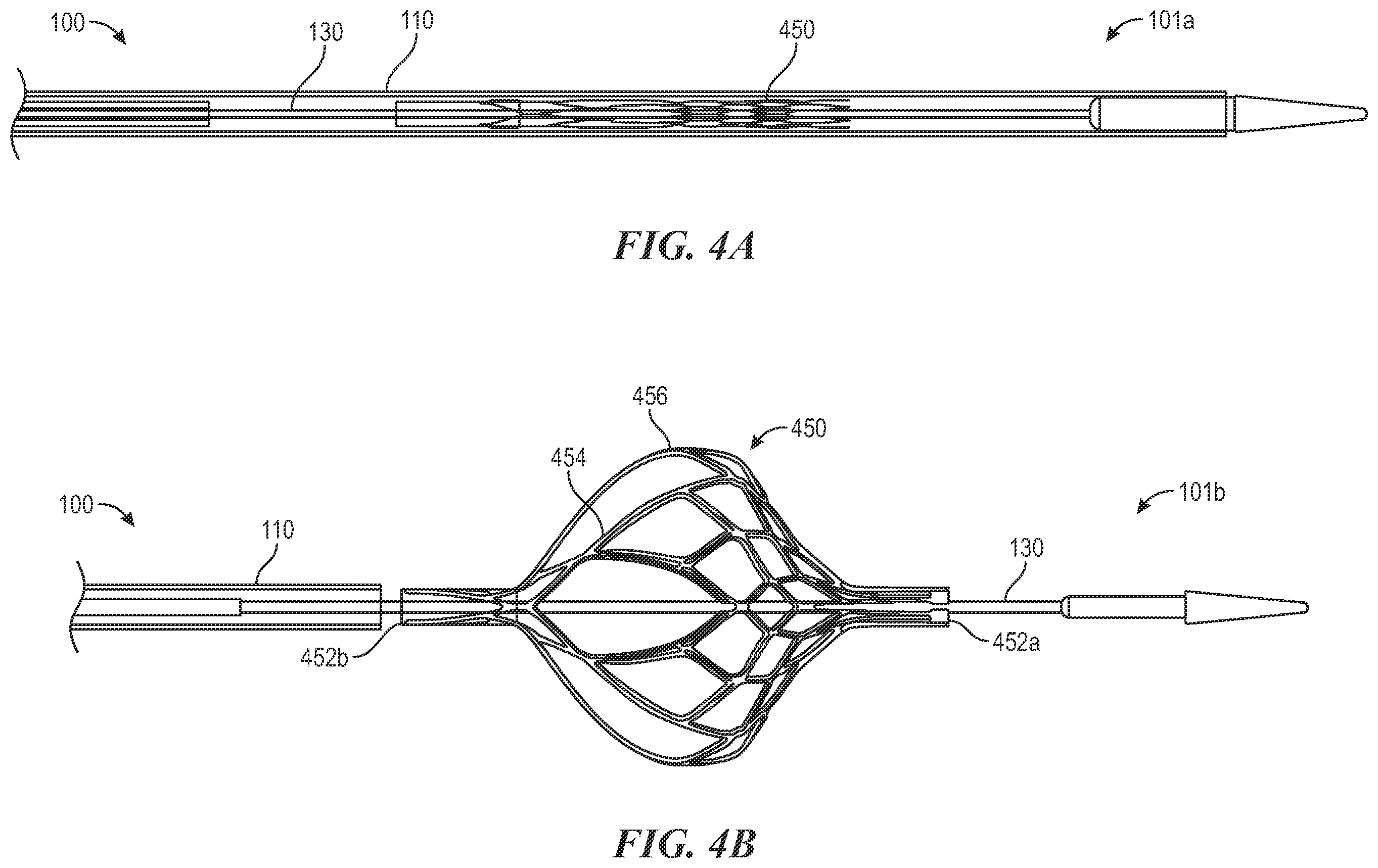 Patent US12496081 Figure 6 – Catheter for use with clot treatment systems