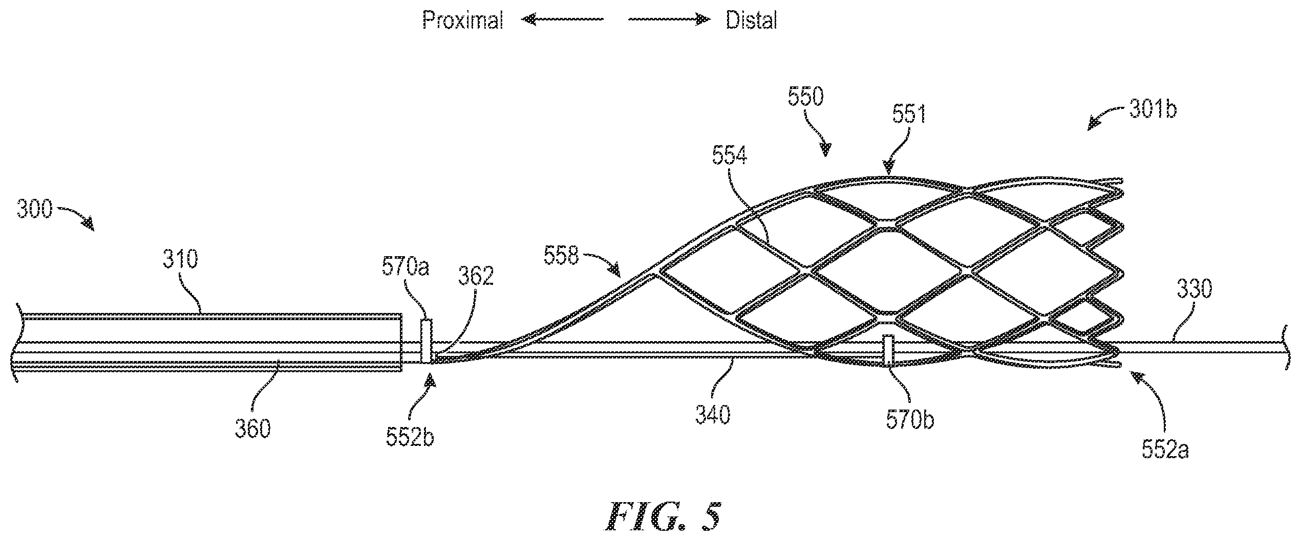 Patent US12496081 Figure 7 – Catheter for use with clot treatment systems