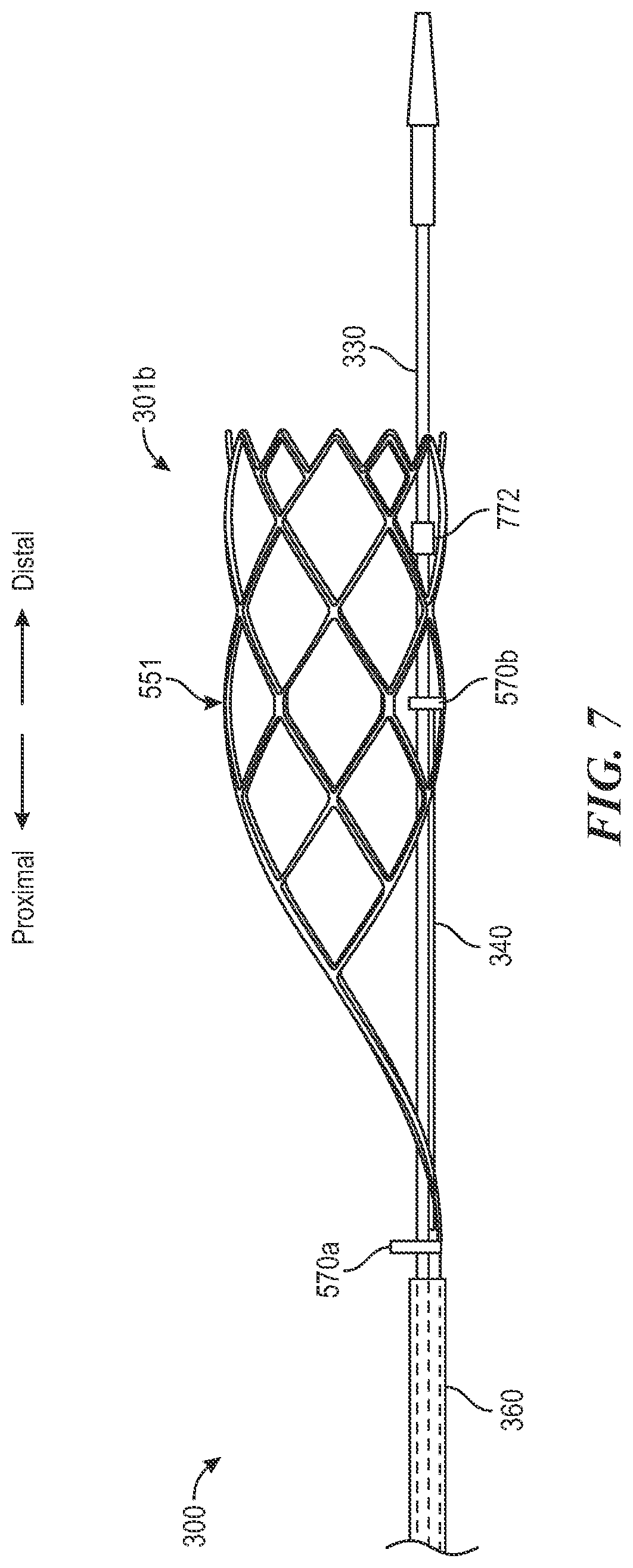 Patent US12496081 Figure 9 – Catheter for use with clot treatment systems