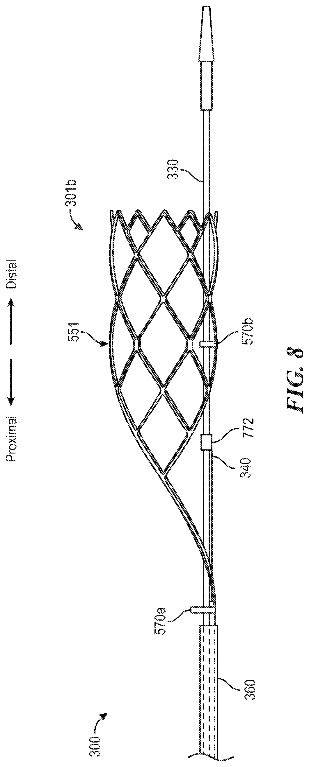 Patent US12496081 Figure 10 – Catheter for use with clot treatment systems