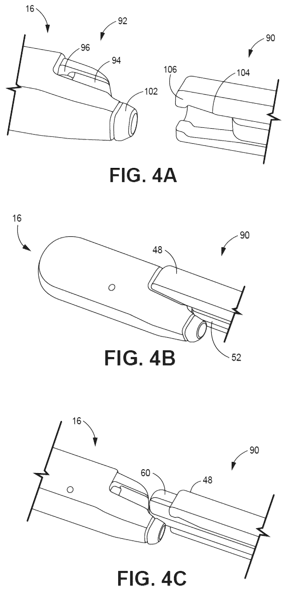 Patent US12496084 Figure 4 – Tunneling and insertion tool for implantable medical device