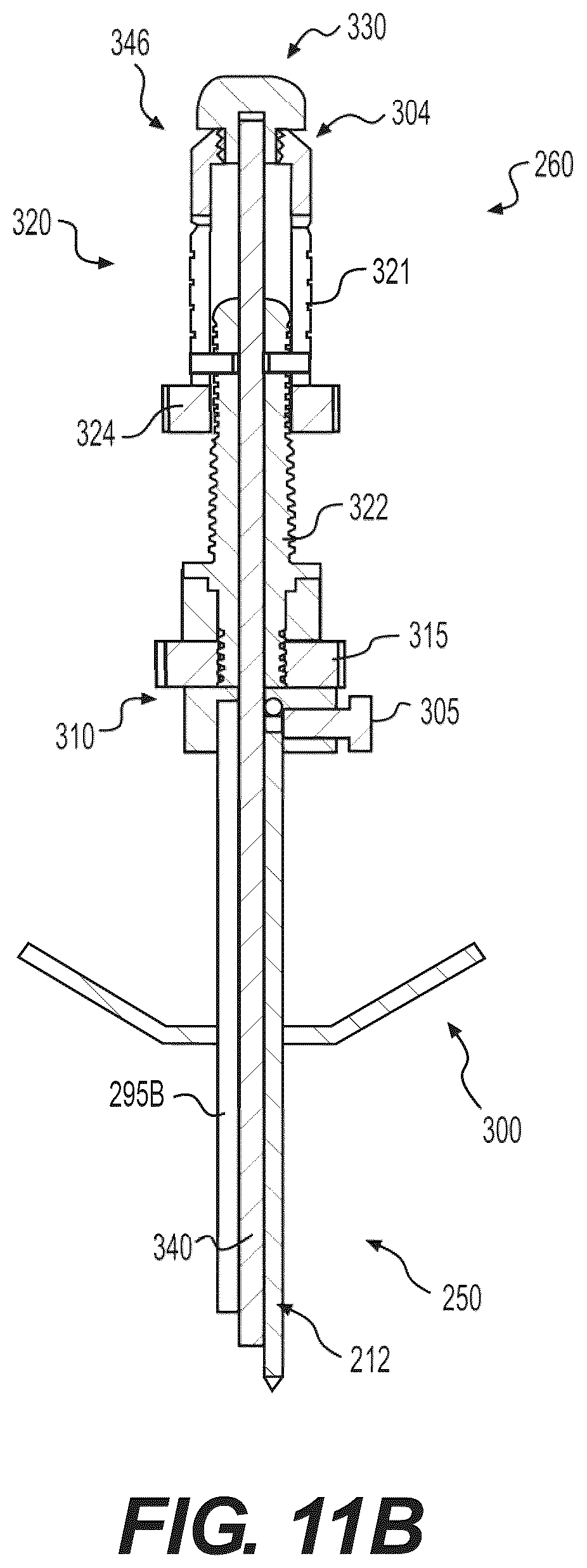 Patent US12496085 Figure 20 – Percutaneous lateral recess resection methods and instruments