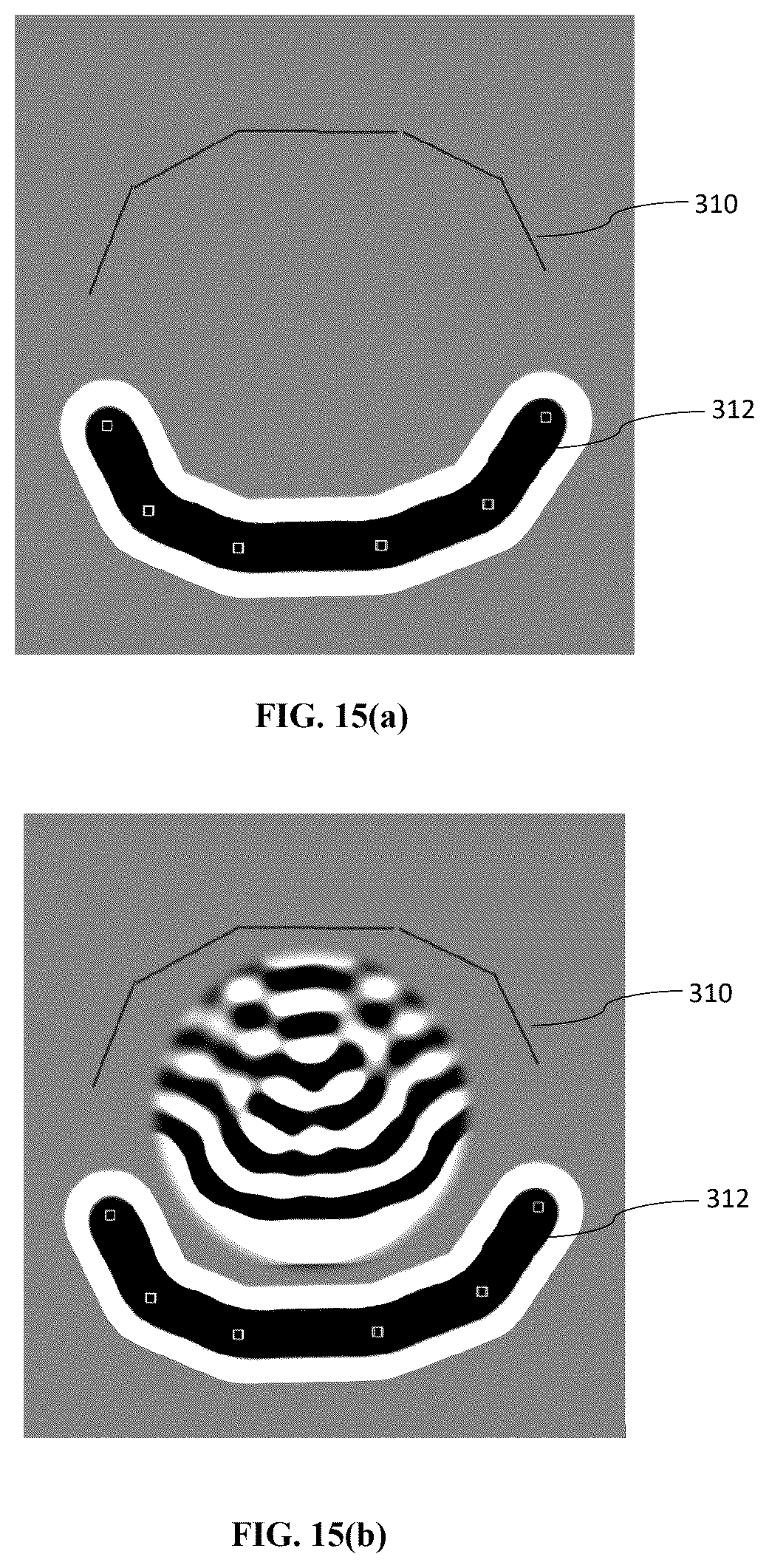 Patent US12496087 Figure 18 – Ultrasonic surgical device