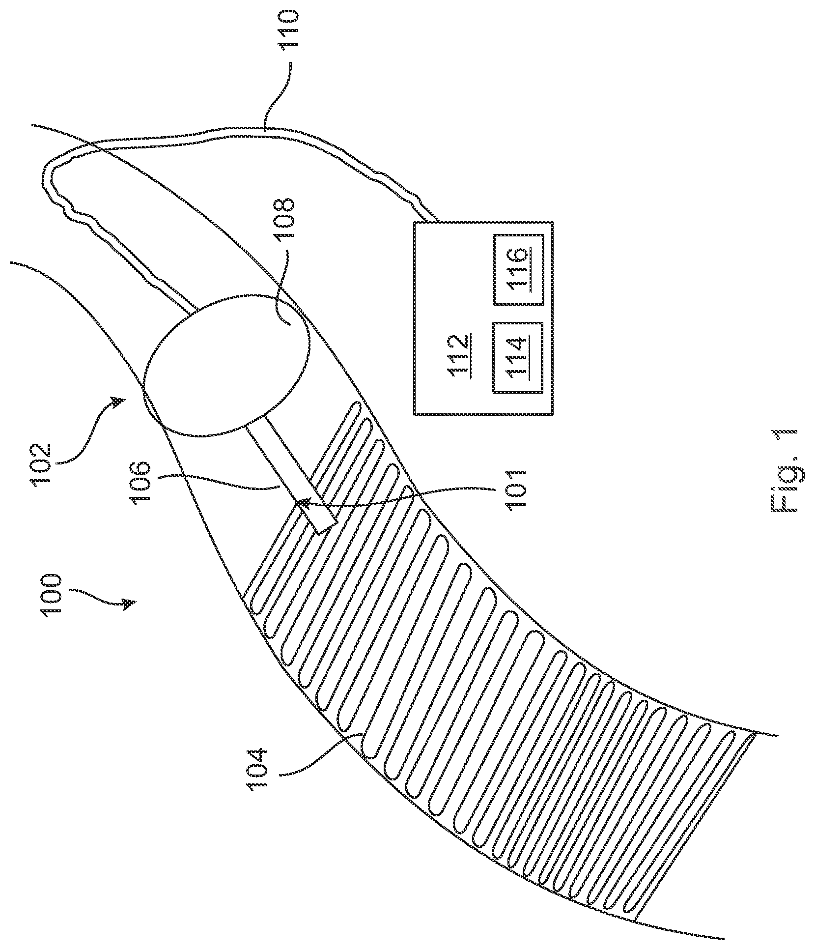 Patent US12496089 Figure 1 – Vessel blockage passing