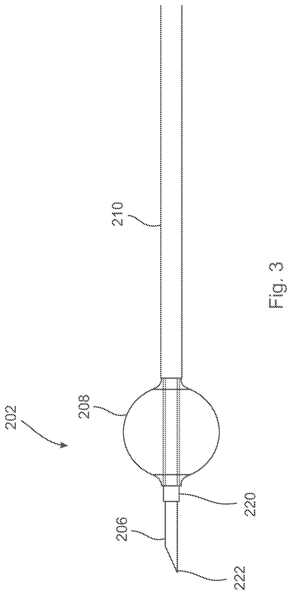 Patent US12496089 Figure 3 – Vessel blockage passing