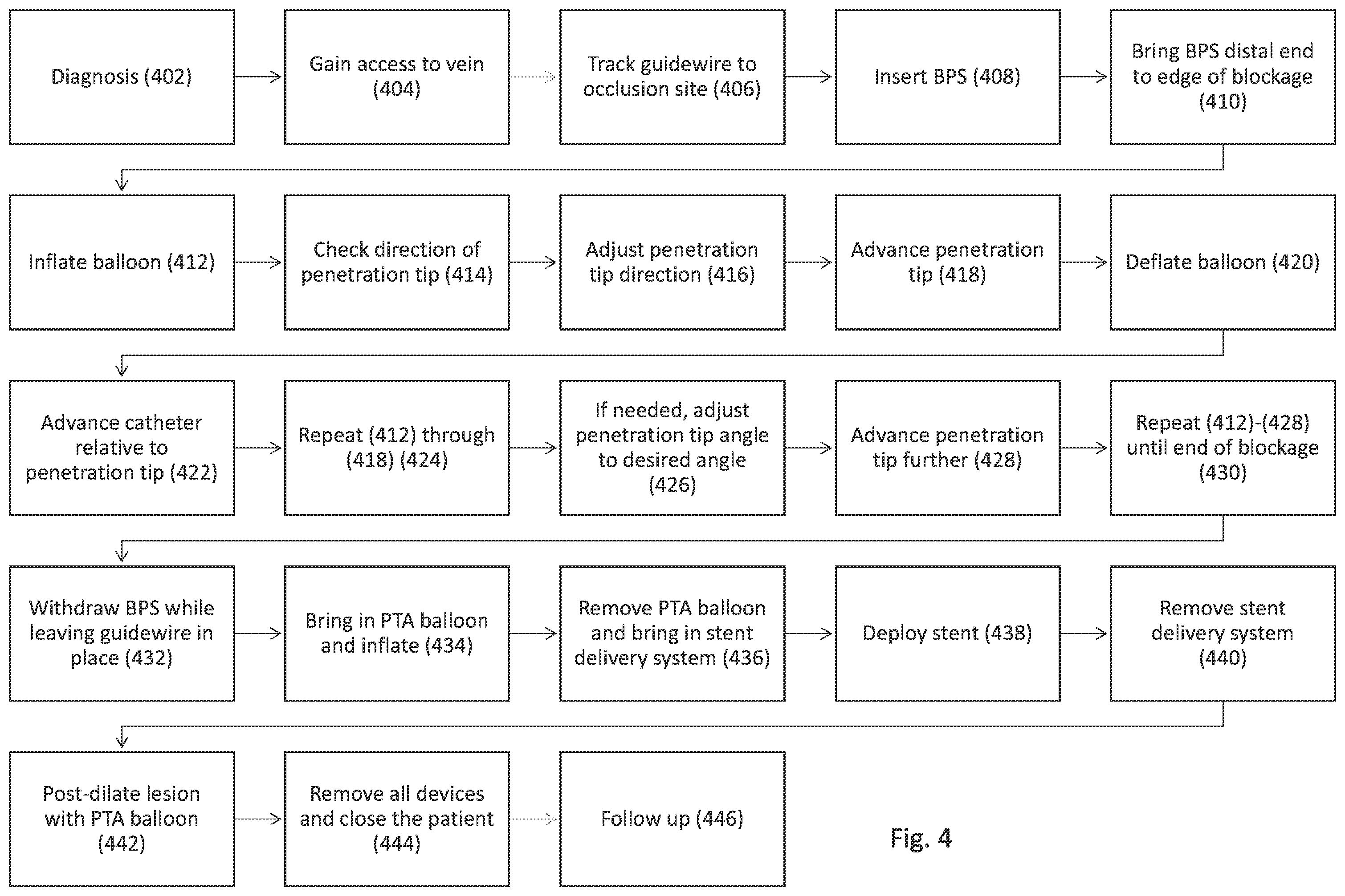 Patent US12496089 Figure 4 – Vessel blockage passing