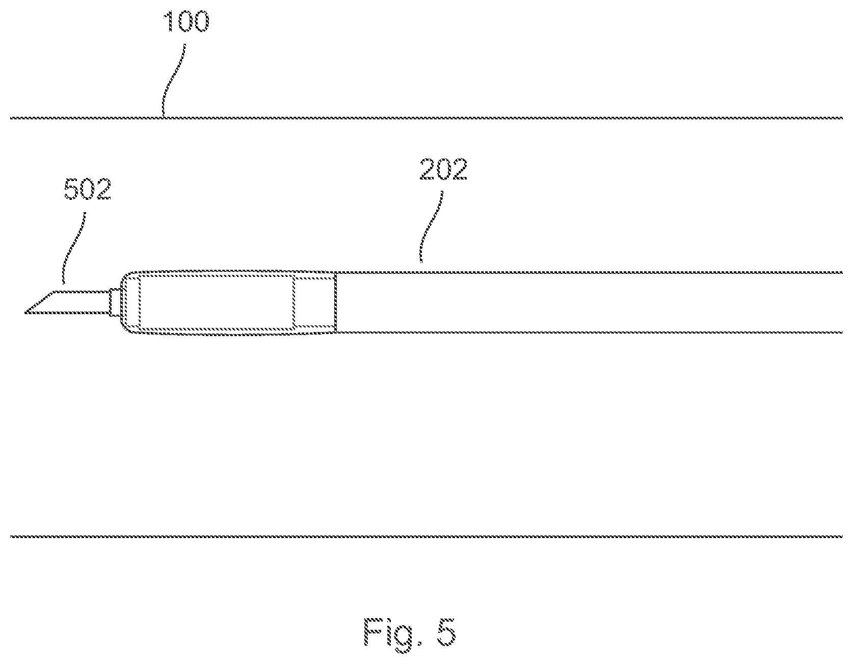 Patent US12496089 Figure 5 – Vessel blockage passing