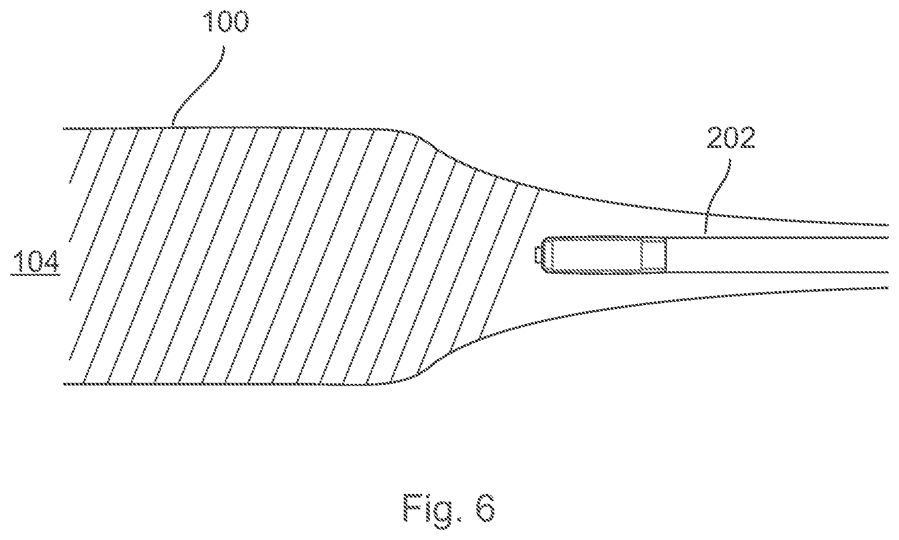 Patent US12496089 Figure 6 – Vessel blockage passing